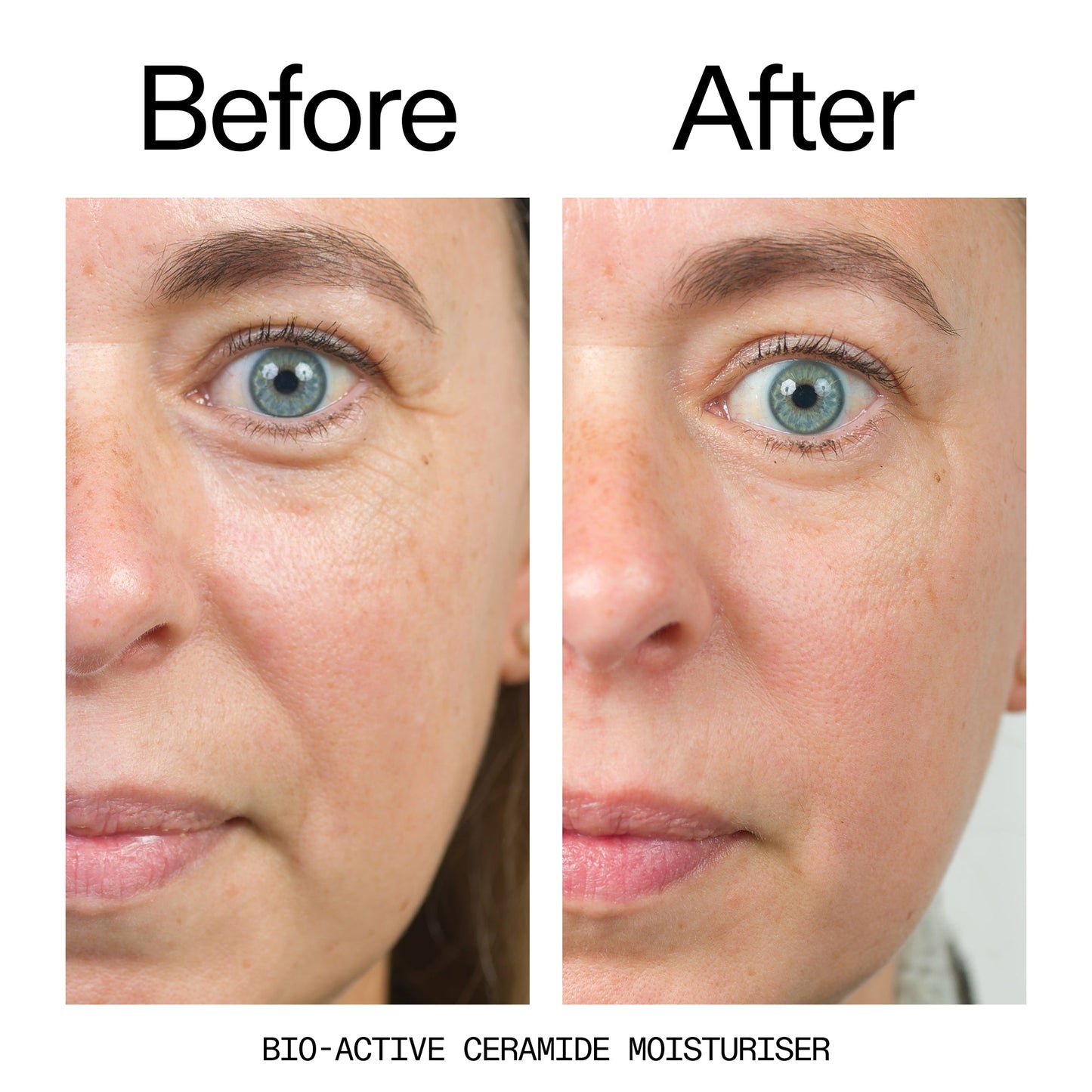 barrier-boosting-trio-n7 Bio-Active_Before_After_2000x2000_600947b4-e8c5-425a-9155-fc15bc83aa12.jpg