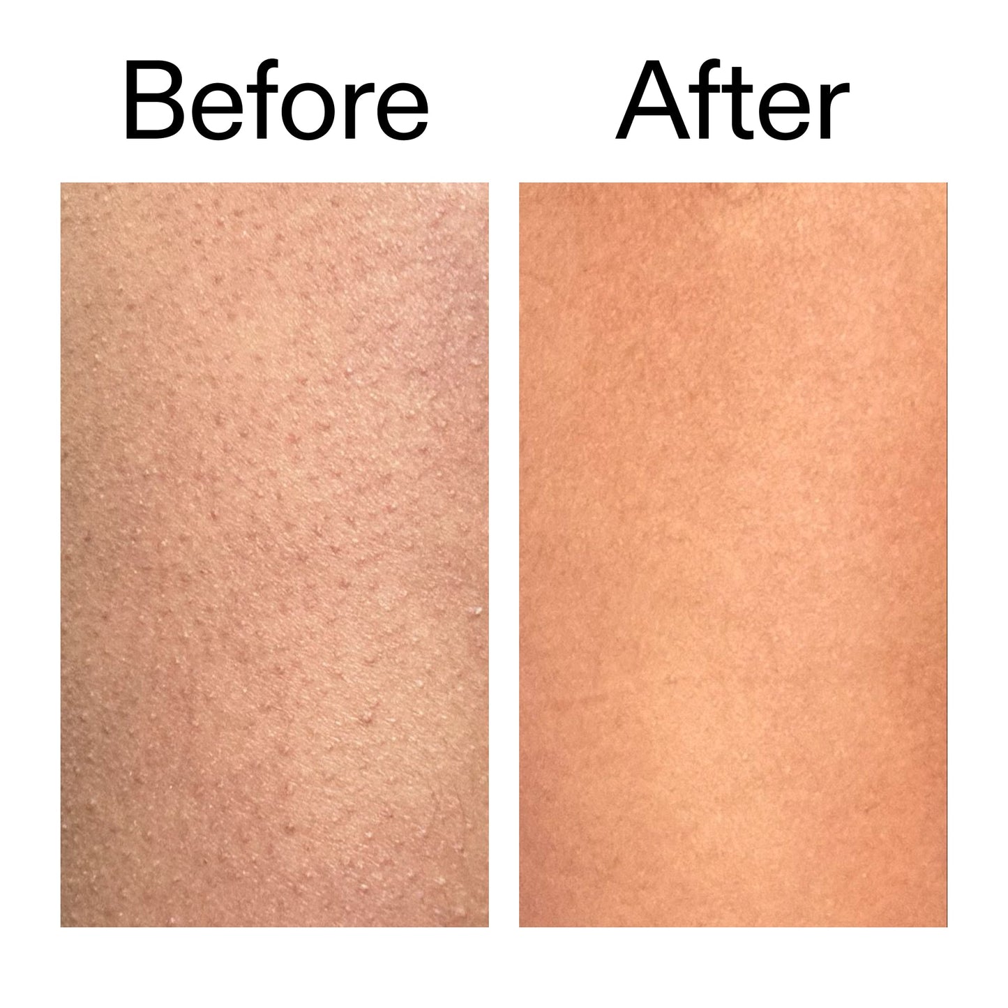 glycolic-acid-exfoliating-body-stick-m3 Glycolic_Body_Stick_B_A_2000x2000_6e6e6b4d-5bd7-43c0-aeed-4d66788e8995.jpg