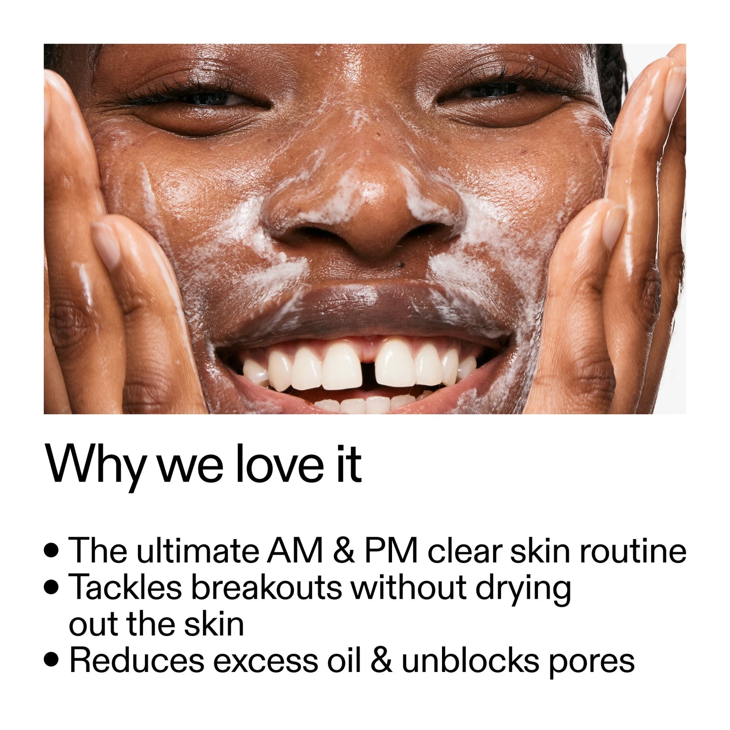 intro-routine-for-acne-v1 Intro_Routine_for_Acne_Why_we_love_it_2000x2000_42499e10-4629-4a0e-a627-7e215f4da6bc.jpg