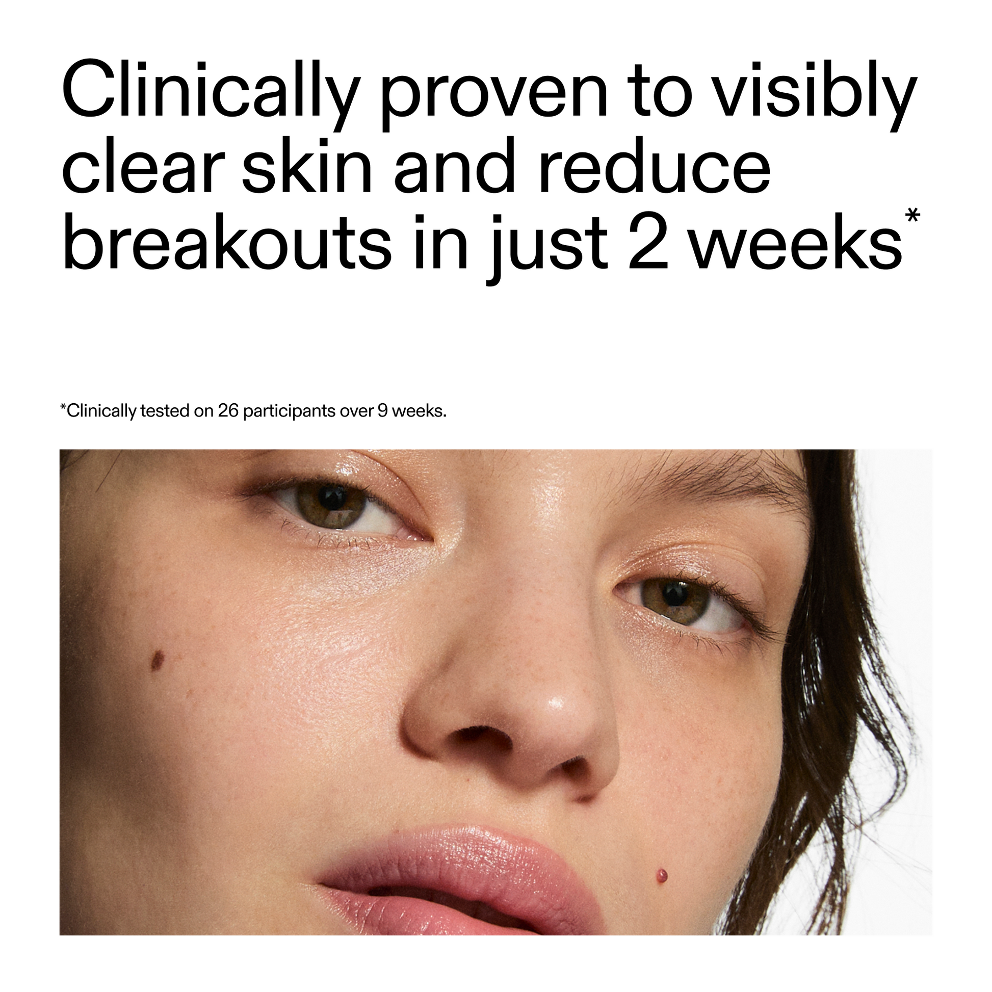 360-acne-clearing-duo-s5 360_Serum_Key_Claim.png