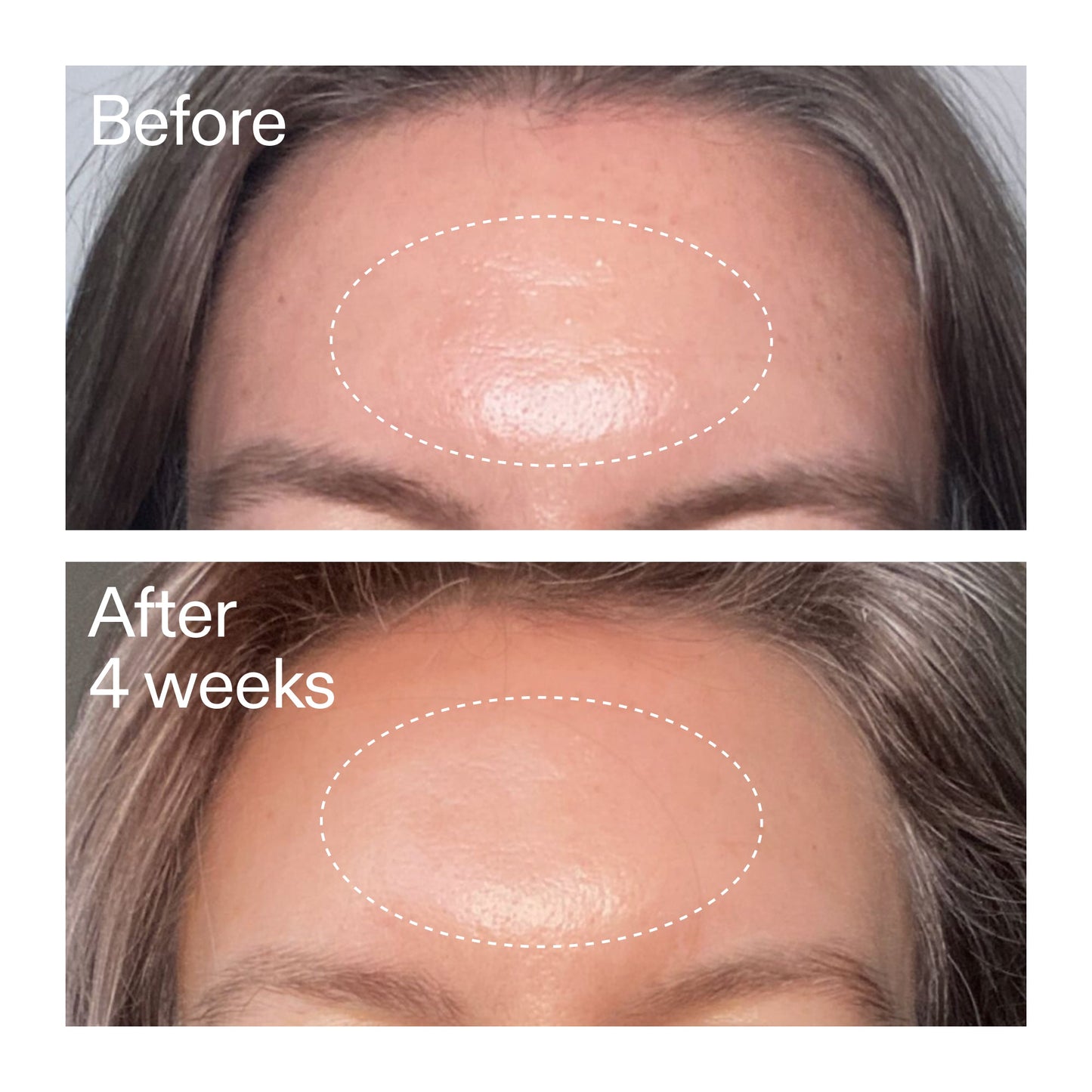 advanced-0-2-retinal-serum-duo-h8 AdvancedRetinal_BeforeAfter1_2000x2000_4e9c798a-f30e-45b8-a34a-7c4740f2f2cb.jpg