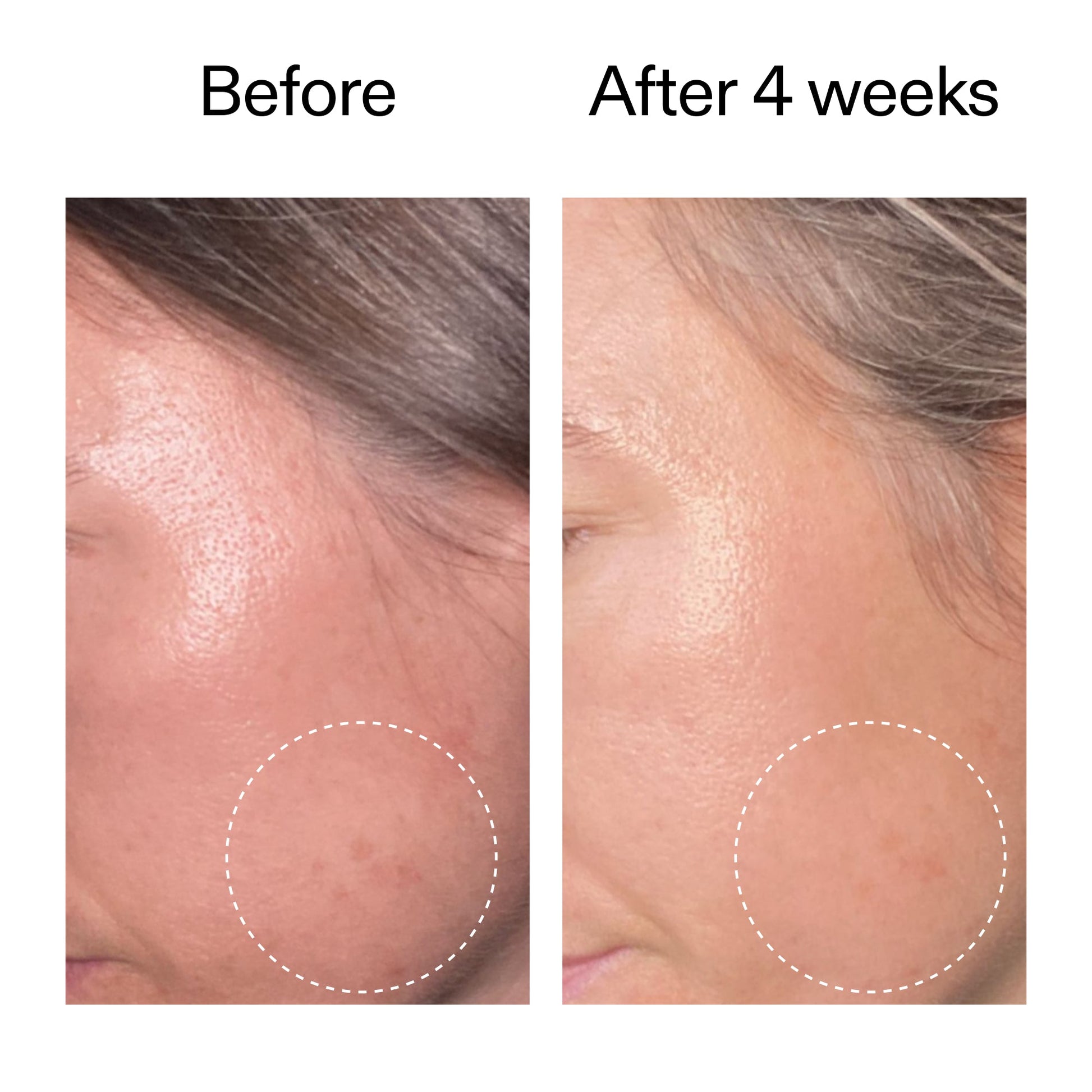 advanced-0-2-retinal-serum-l4 AdvancedRetinal_BeforeAfter2__2000x2000_62fb16bb-77ae-4d63-8500-88dbf847f4b9.jpg