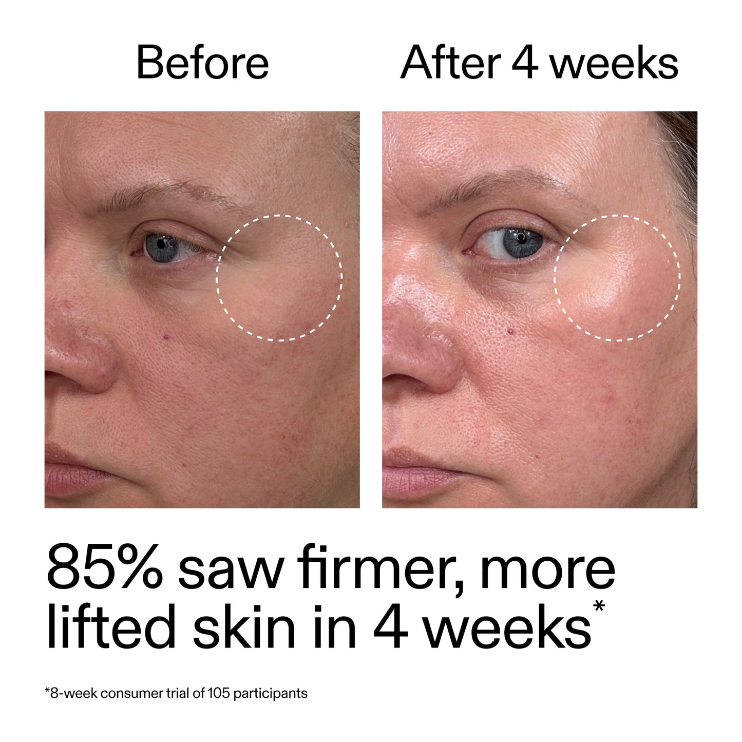 advanced-0-2-retinal-serum-duo-h8 AdvancedRetinal_BeforeAfter_Claim1_2000x2000_3a315aa8-f408-4b33-bbeb-0d9209f98404.jpg
