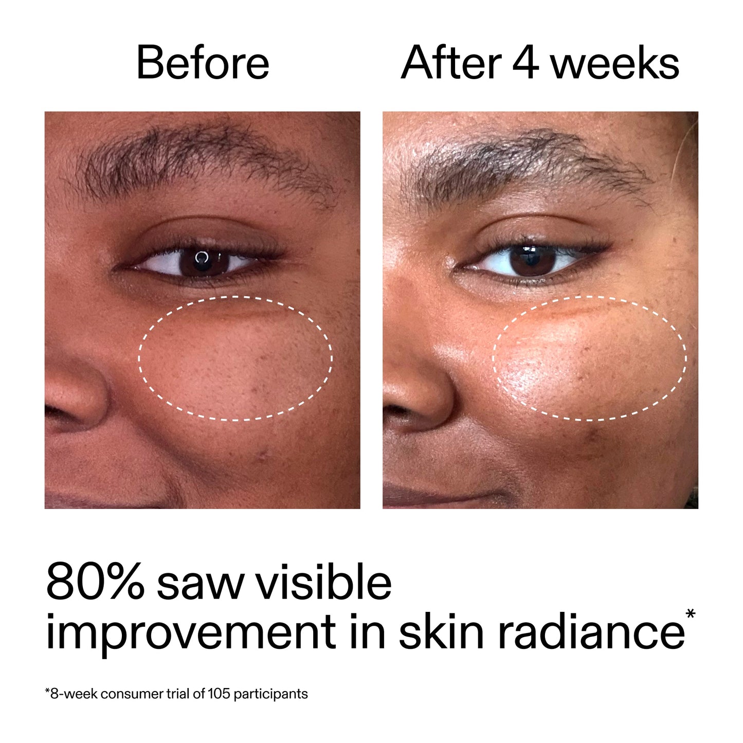 advanced-0-2-retinal-serum-l4 AdvancedRetinal_BeforeAfter_Claim2_2000x2000_39d11e3d-eda9-44ec-ab32-2903b1a368bd.jpg