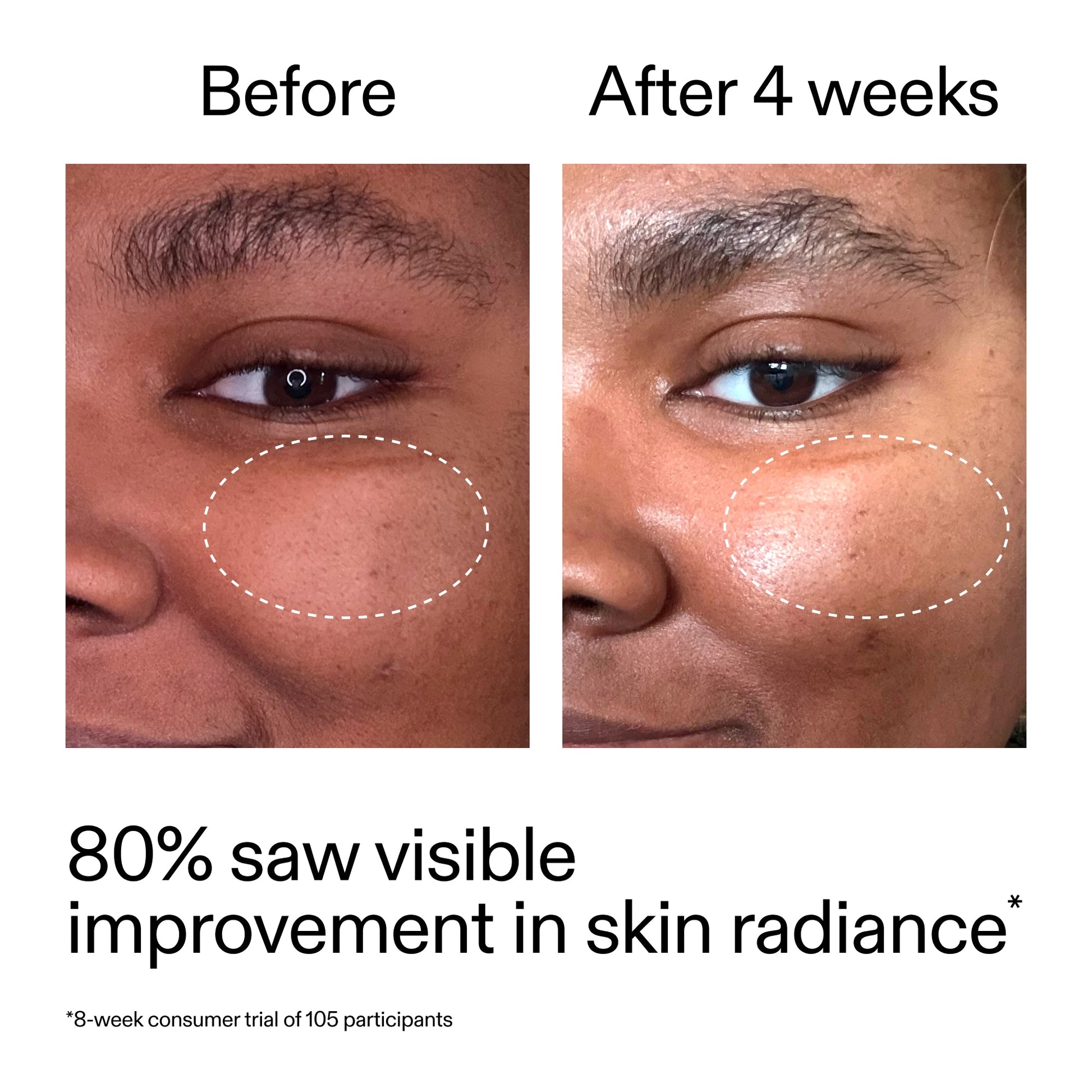 advanced-0-2-retinal-serum-l4 AdvancedRetinal_BeforeAfter_Claim2_2000x2000_39d11e3d-eda9-44ec-ab32-2903b1a368bd.jpg