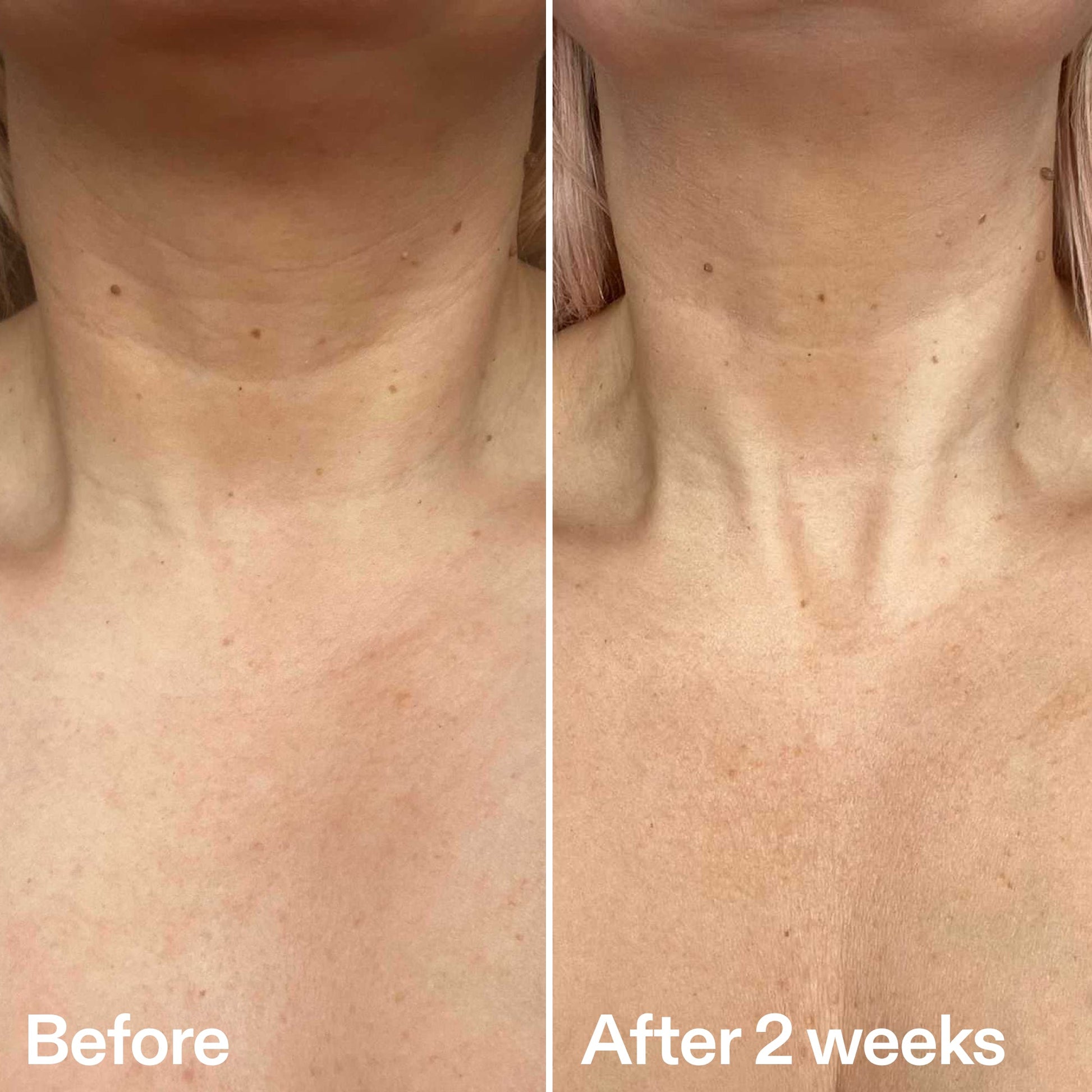 bio-active-neck-lift-stick-y7 B_A_2.jpg
