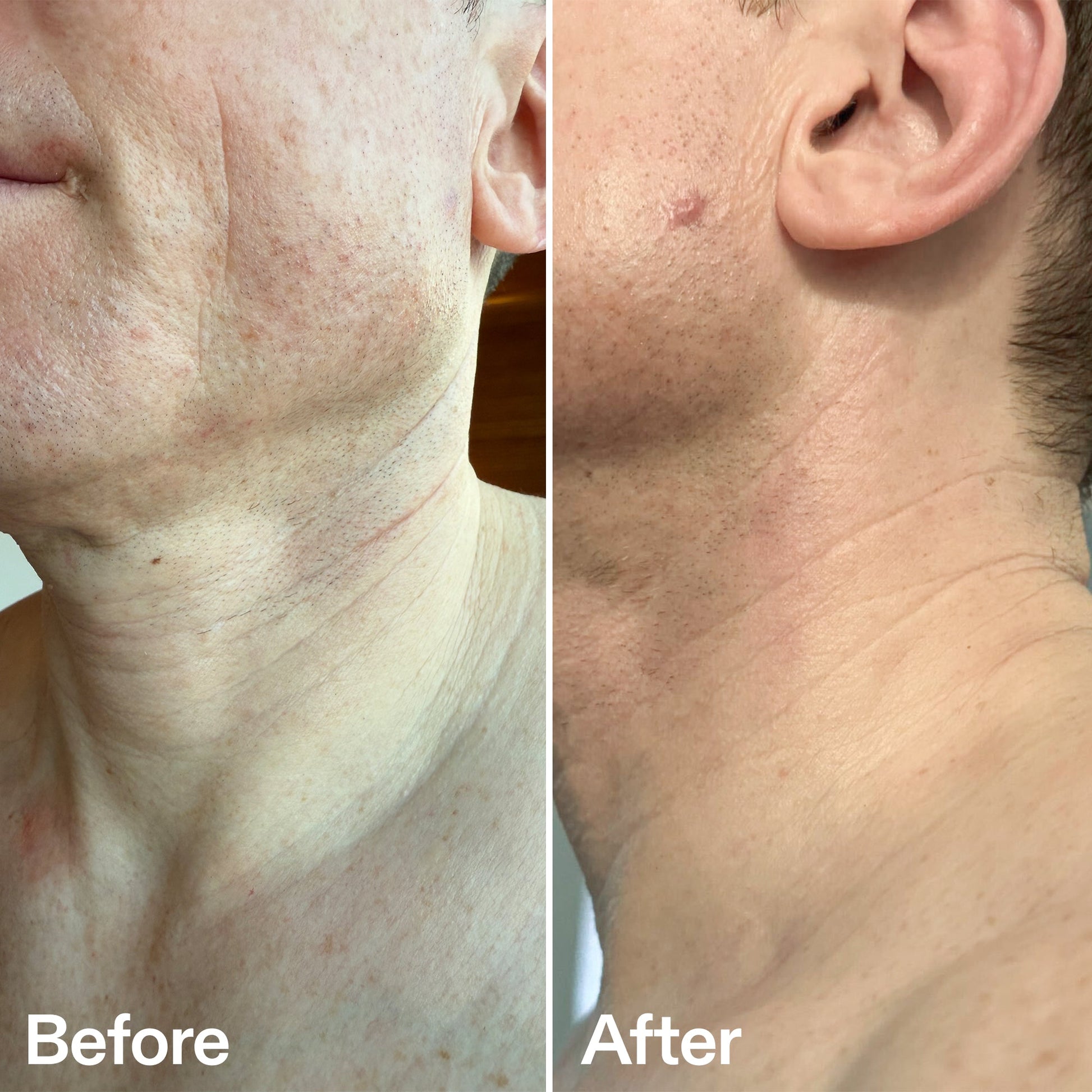 bio-active-neck-lift-stick-y7 B_A_afa2743e-b8e2-4504-92f4-e281cb6cf759.jpg