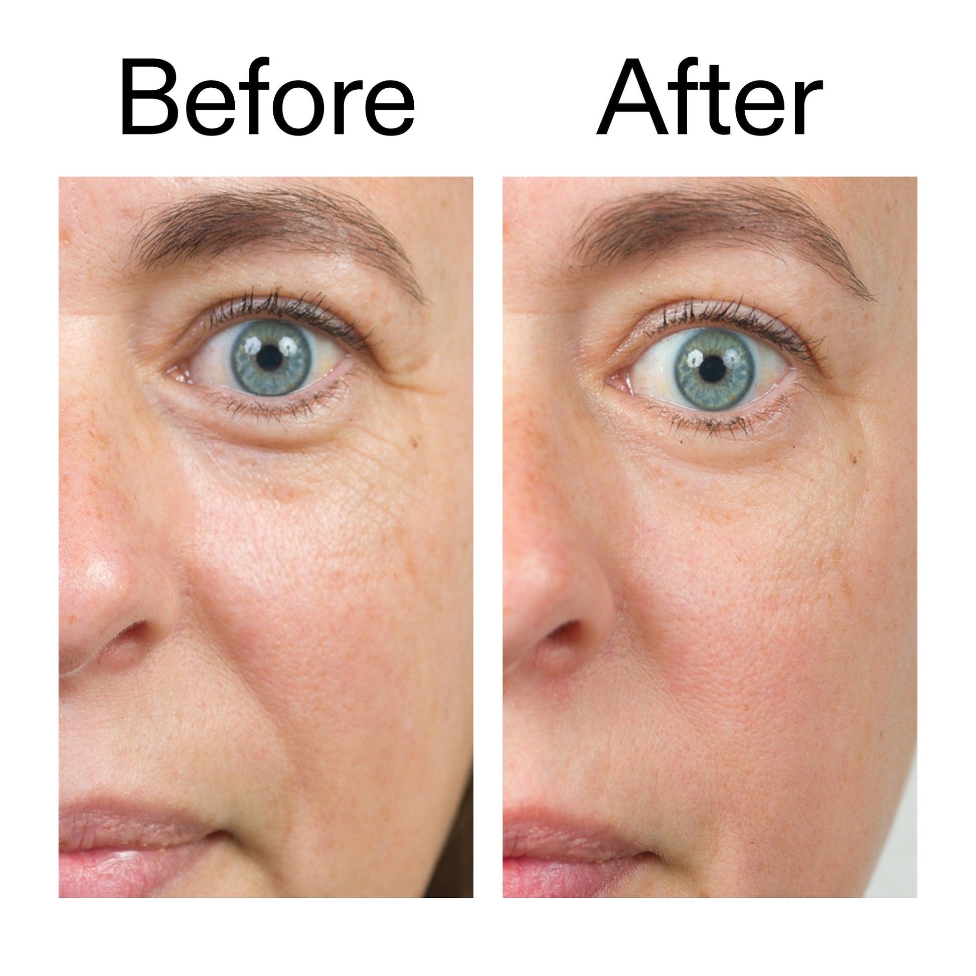 bio-active-ceramide-moisturizer-duo-o8 Bio-Active_Before_After_2000x2000_566e5a9e-135e-417a-8242-b44e5fa35463.jpg