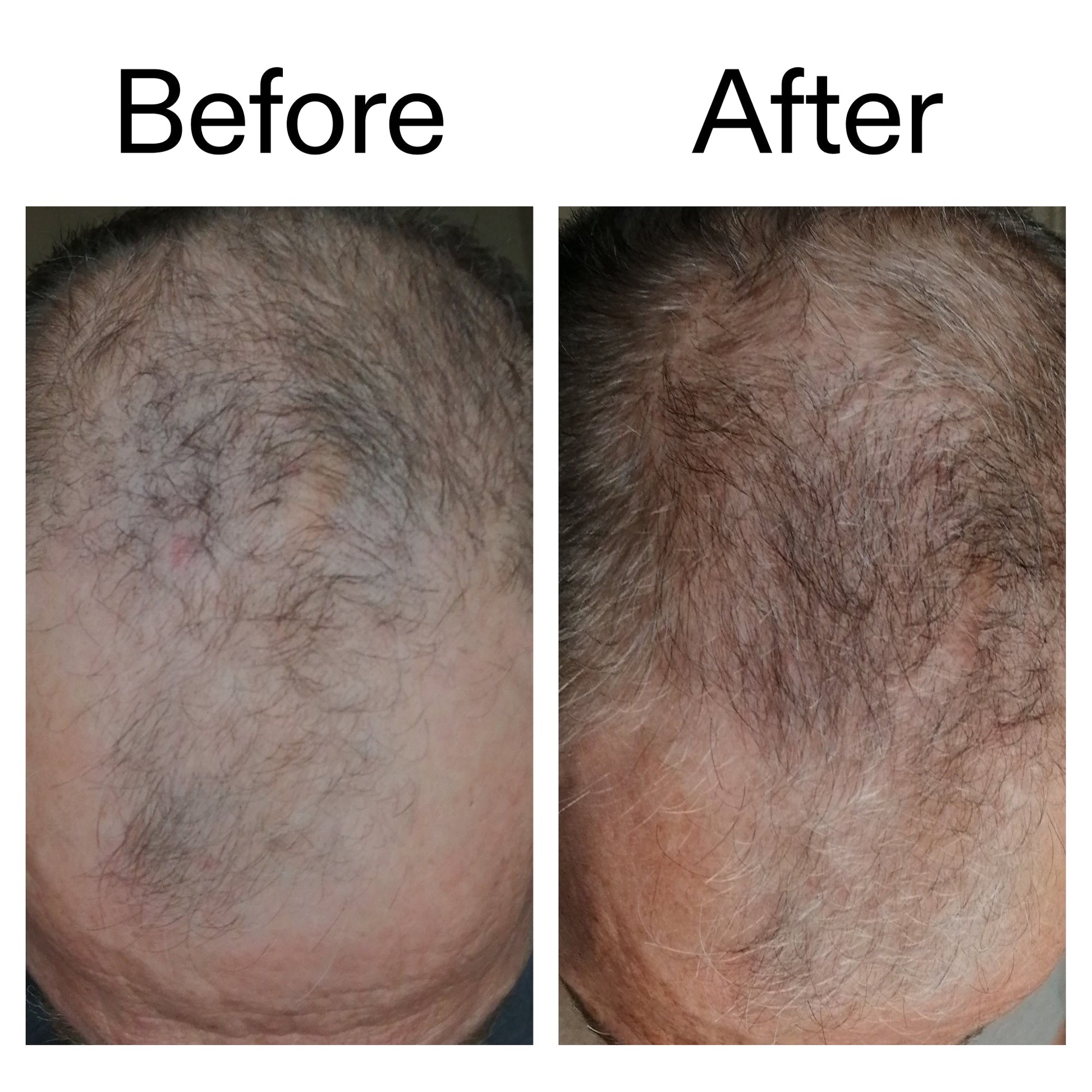 3-month-hair-growth-trio-v4 Caffeine_Scalp_Treatment_B_A_Ppage_2000_x_2000.jpg