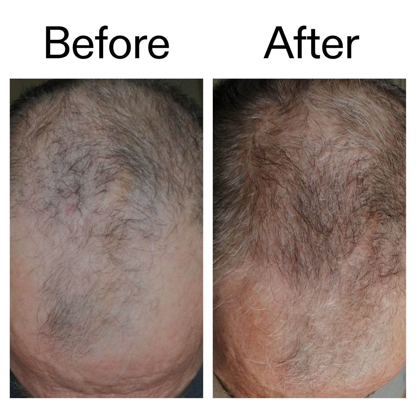 caffeine-stimulating-scalp-treatment-b2 Caffeine_Scalp_Treatment_B_A_Ppage_2000_x_2000.jpg