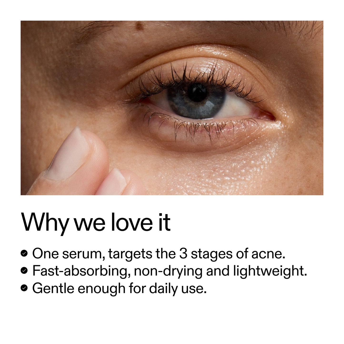360-acne-clearing-duo-s5 Dioic_Whyweloveit_2000x2000_175aafd3-0cbe-403a-b317-a8362881bfe2.jpg