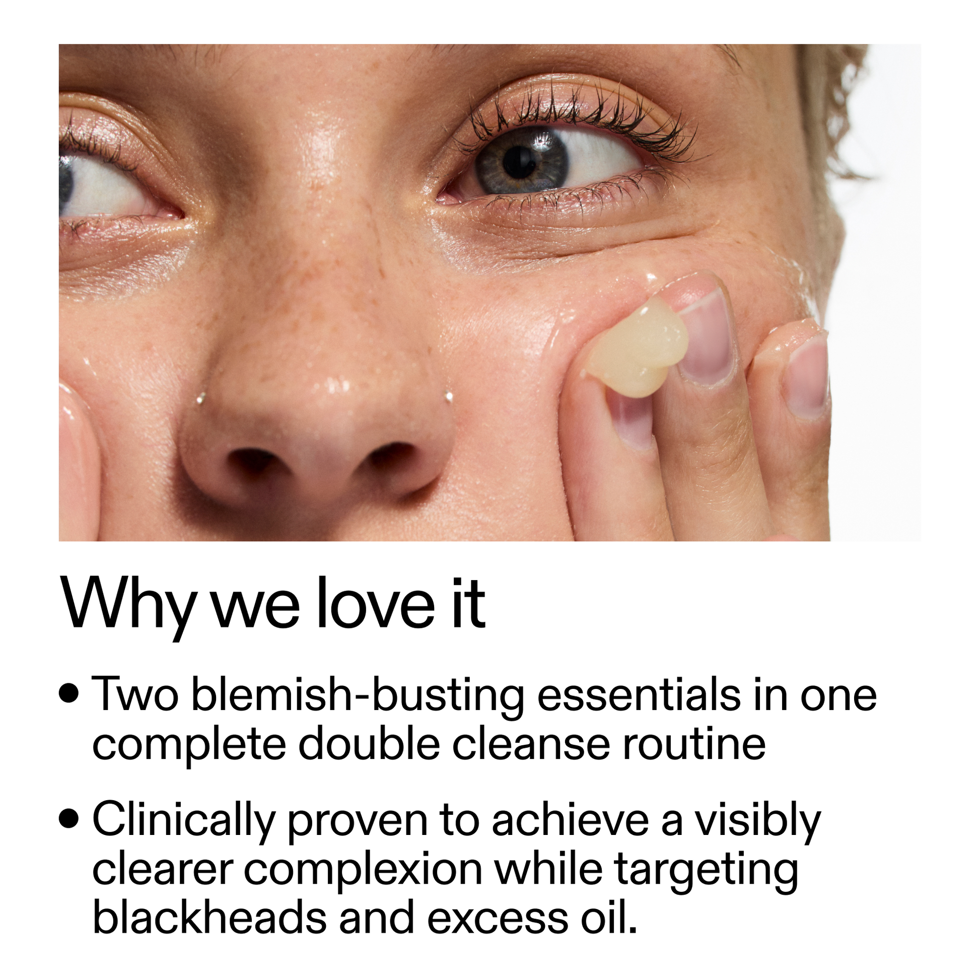 acne-double-cleanse-duo-m0 Double_Cleanse_Duo_for_Breakouts_Why_We_2000x2000_f242cb12-bb5c-487c-b203-071ccb406ec5.png