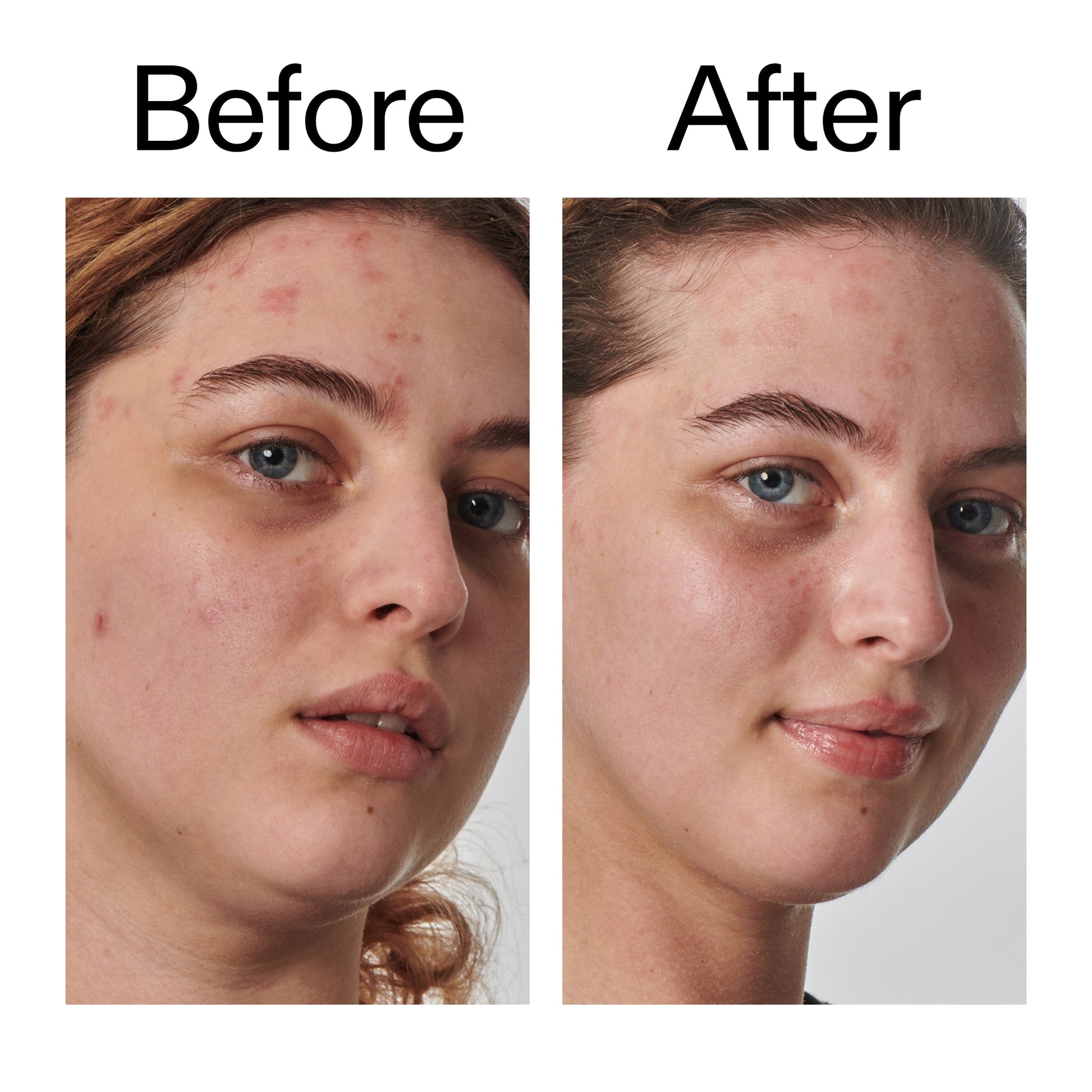 10-urea-moisturizer-q2 Dry_and_Rough_Skin_Solution_Before_After_2000x2000_efa6e639-5c39-49bd-a5dd-f0220293120a.jpg