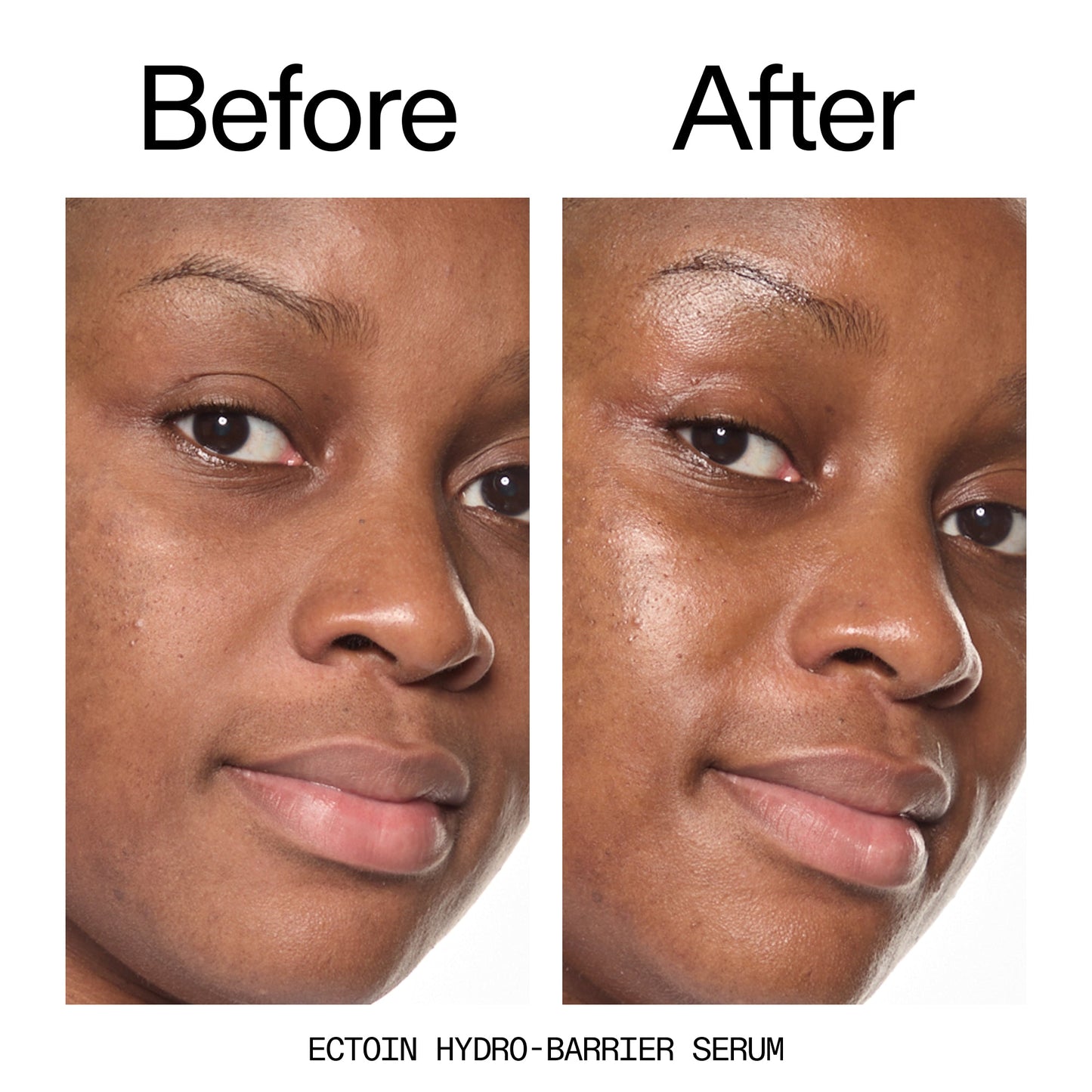 barrier-boosting-trio-n7 Ectoin_Before_After_2000x2000_ce35bc41-4da0-4b6f-adc7-29f8641f6c6c.jpg