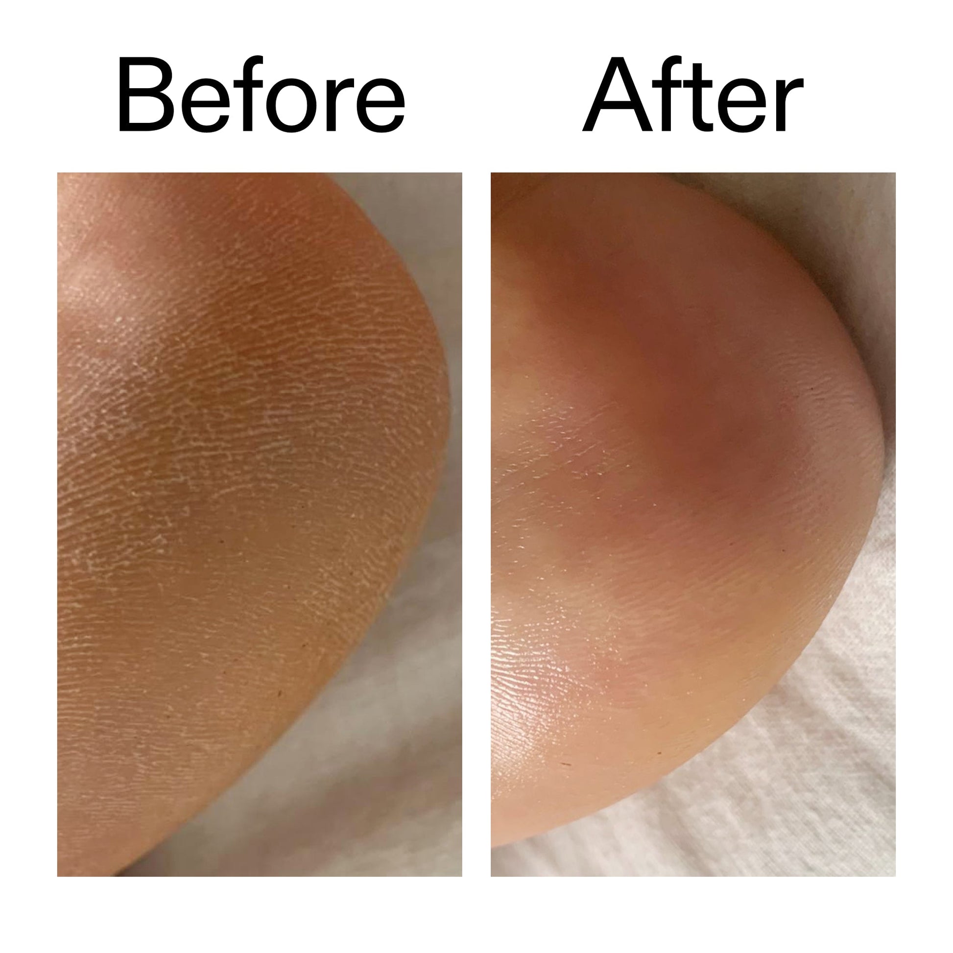 glycolic-acid-exfoliating-body-stick-duo-o8 Glycolic_Acid_Exfoliating_Body_Stick_Before_After_V1_2000x2000_a3043625-9400-429a-a7fb-d6dbd220f722.jpg