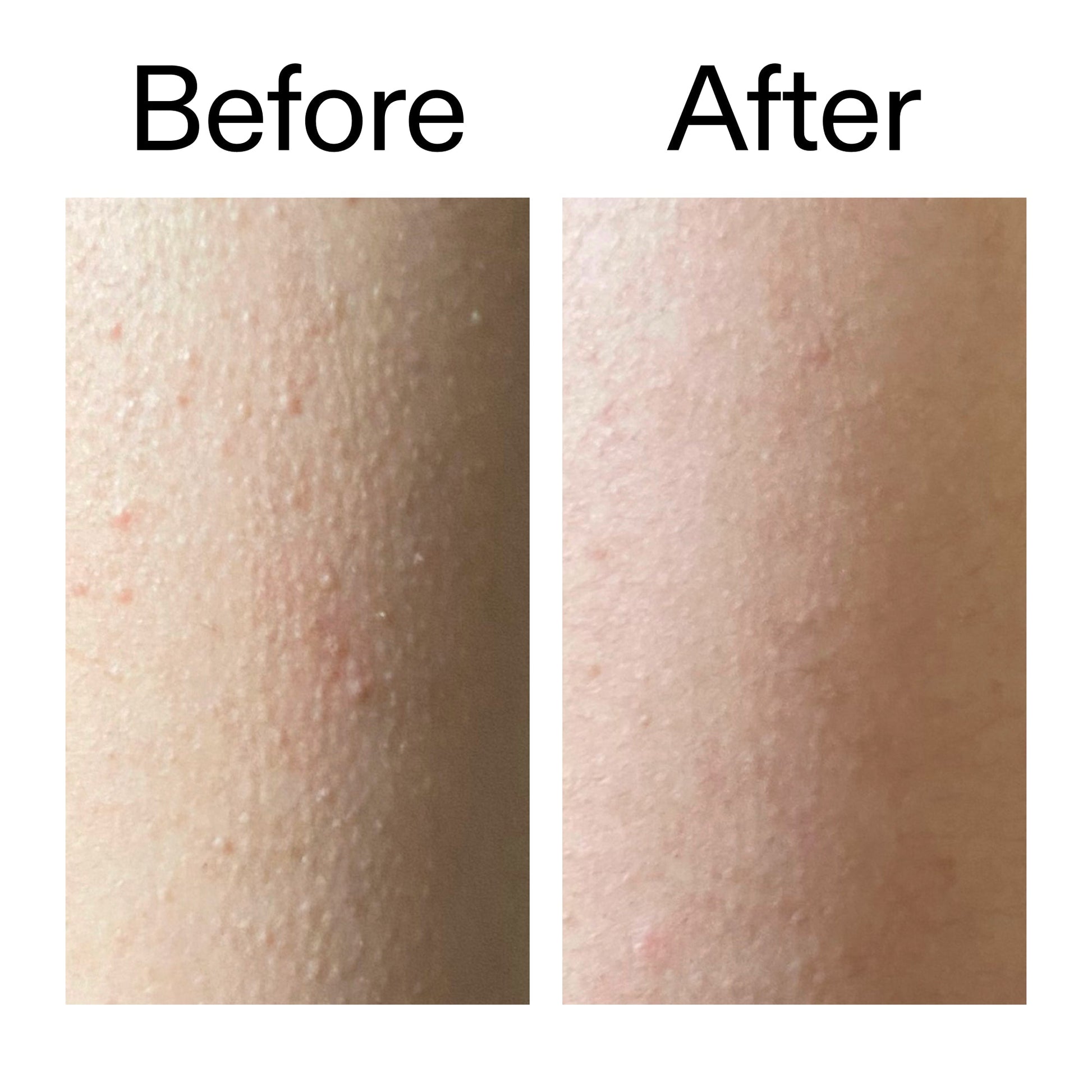 glycolic-acid-exfoliating-body-stick-m3 Glycolic_Acid_Exfoliating_Body_Stick_Before_After_V2_2000x2000_2e4ba052-94f6-4d56-82df-7bdb5b2df7ae.jpg