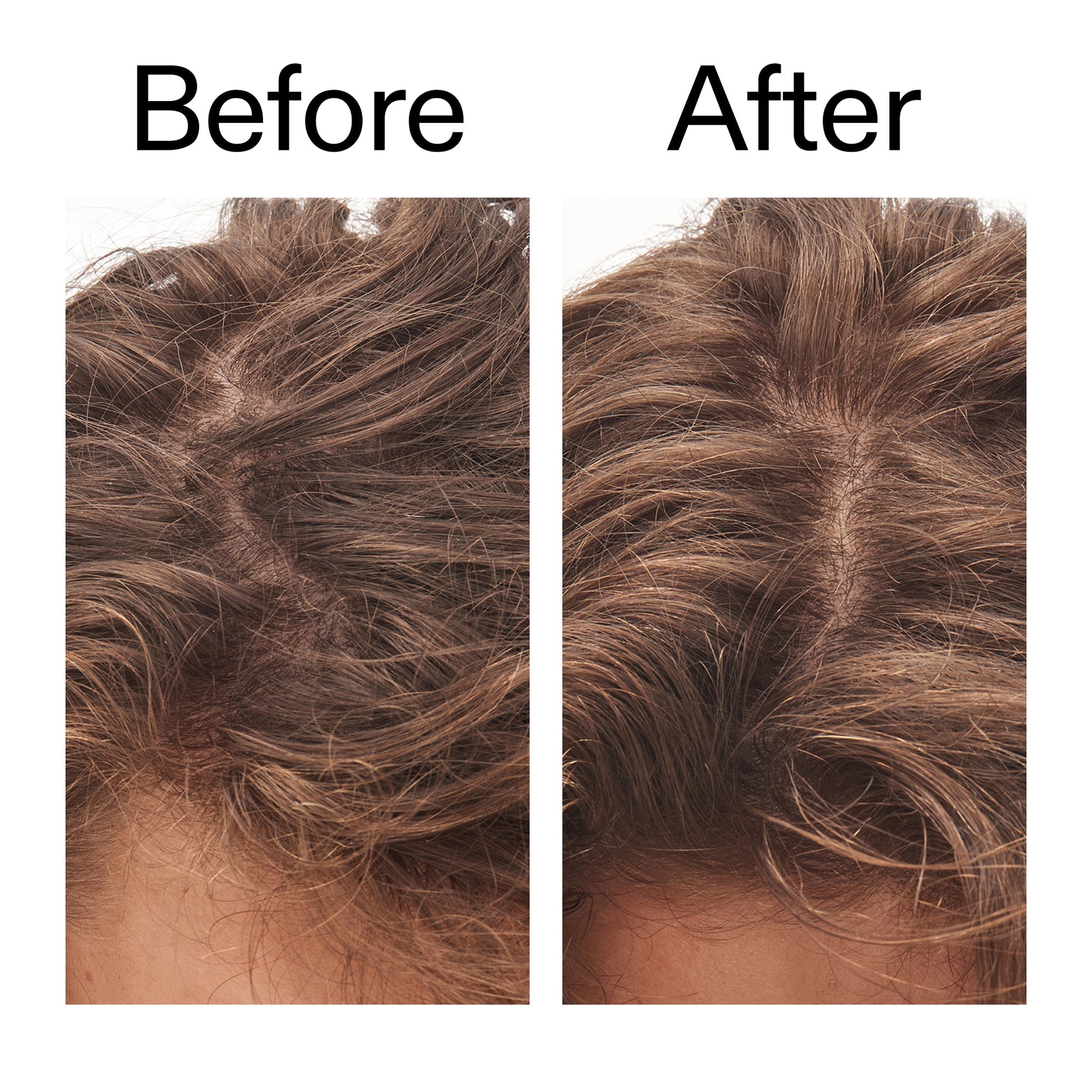 glycolic-acid-exfoliating-scalp-scrub-v4 Glycolic_Acid_Exfoliating_Scalp_Scrub_Before_After_2000x2000_b8561c87-05a1-4caa-80f7-1b6b33d750f7.jpg