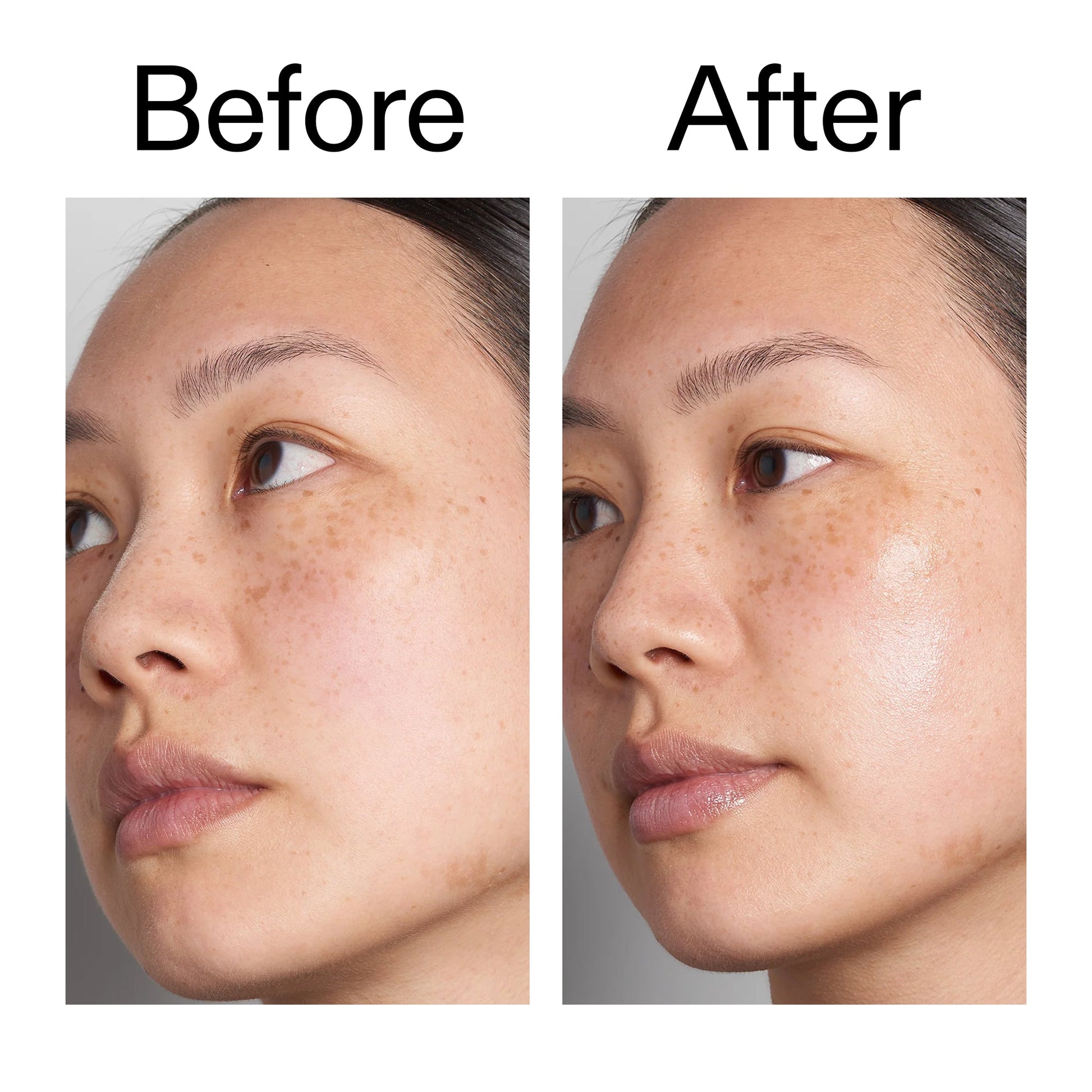 hyaluronic-acid-serum-60ml-v4 Hyaluronic_Acid_Before_After_2000x2000_d7983956-8aa2-4ea3-8255-c63e8d4f892e.jpg