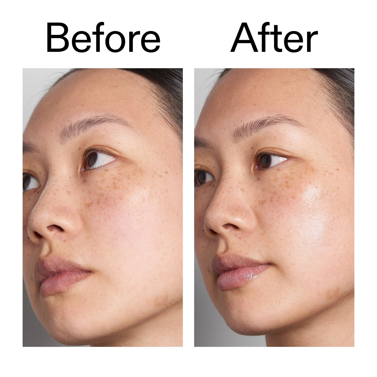 supersize-hyaluronic-acid-serum-100ml-duo-x5 Hyaluronic_Acid_Before_After_2000x2000_d7983956-8aa2-4ea3-8255-c63e8d4f892e.jpg
