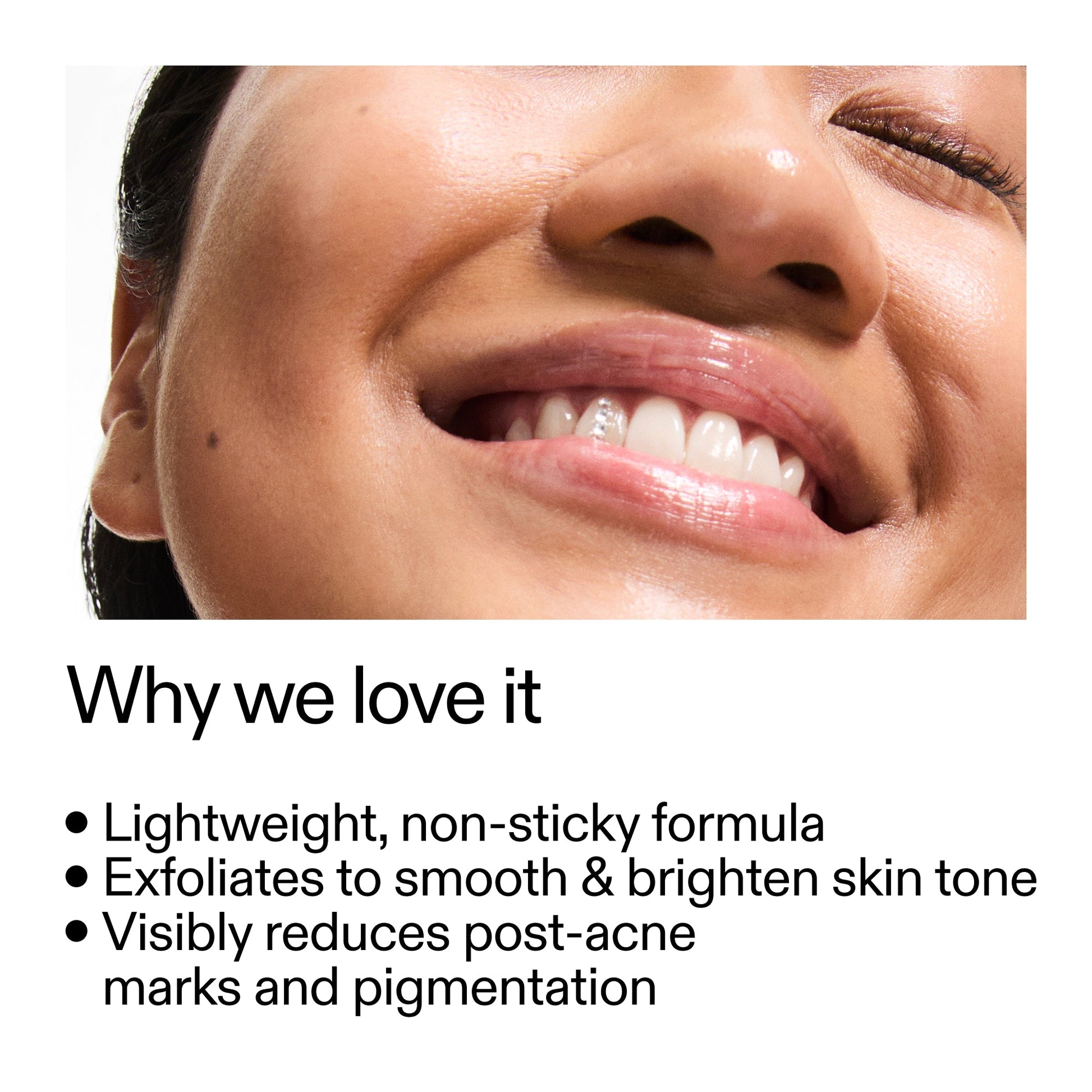 mandelic-acid-treatment-r6 Mandelic_Acid_Treatment_Why_we_love_it_2000x2000_6dfe29a9-2a79-464f-a5e8-e5ac37d93388.jpg
