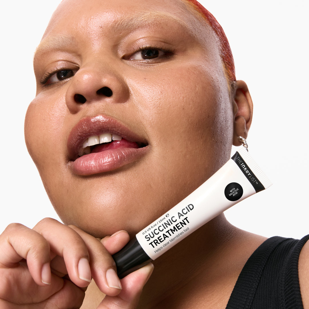 succinic-acid-acne-treatment-f9 Model01_e1f52024-eb96-4c7c-a900-953f384d8523.jpg