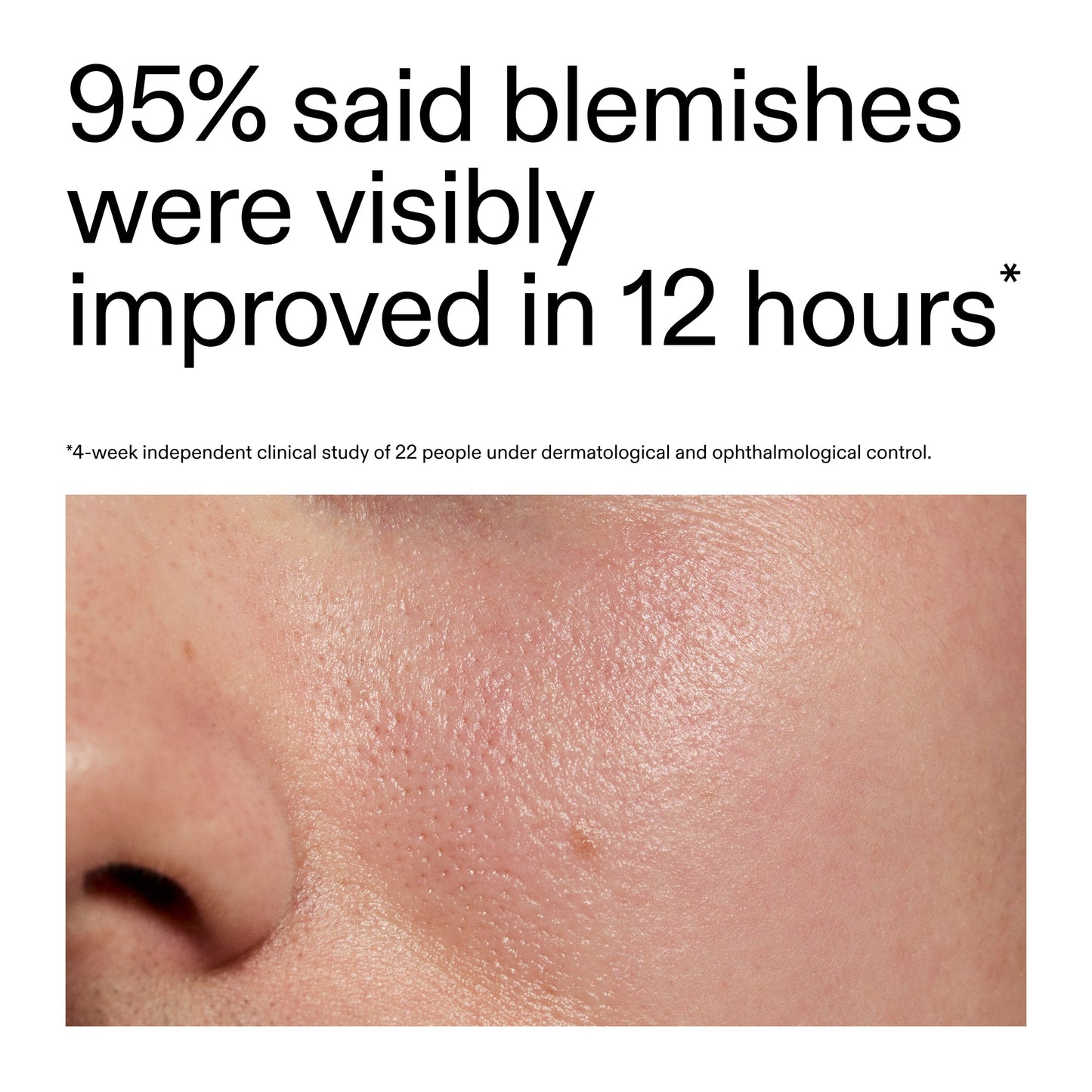 succinic-acid-acne-treatment-f9 Oat_Cleansing_Balm_Claim_2000x2000_ac6ce553-25db-41b2-a981-faae1ac4b8c0.jpg