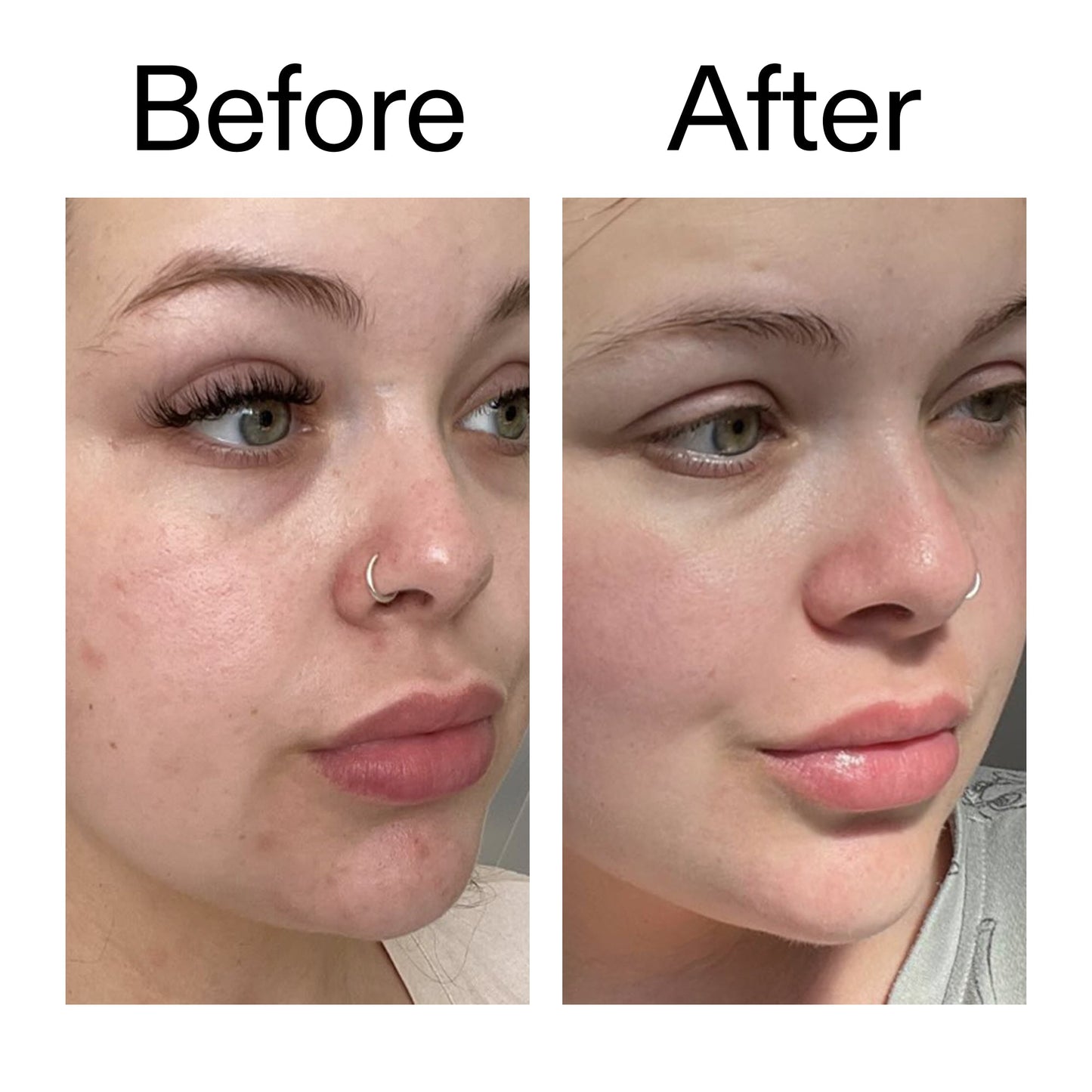 supersize-omega-water-cream-duo-e8 Omega50_Before_After_2000x2000_46483ed8-3f9d-487f-9a0c-9df79830bd65.jpg