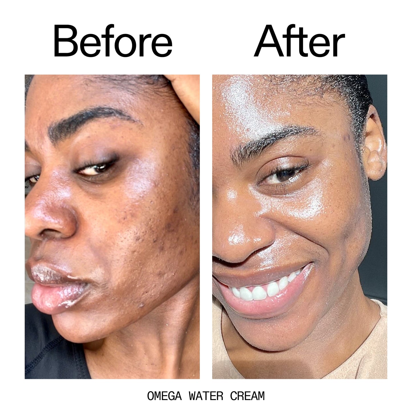 hydrating-cleanser-and-moisturizer-duo-l7 Omega_Water_Cream_Before_After_2000x2000_8e88278b-8c8d-48dc-ac77-4e98ebbd1b77.jpg