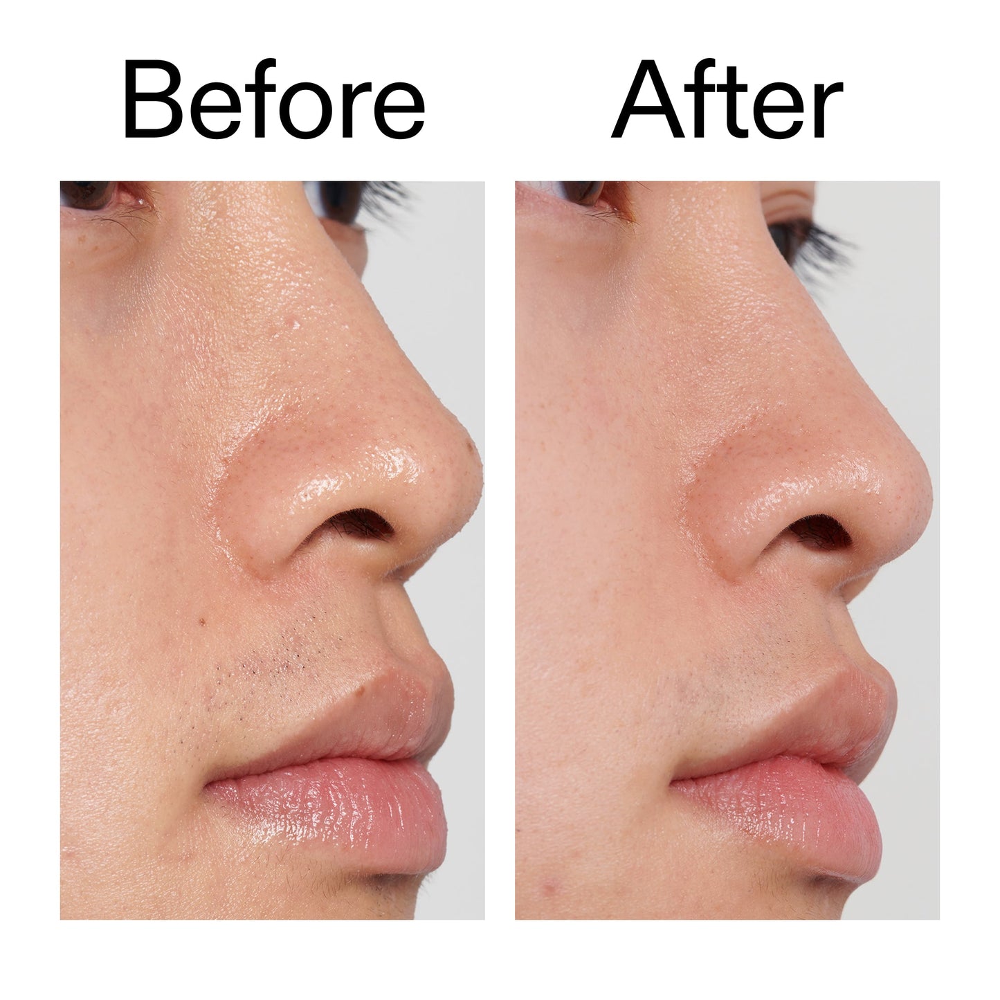 pha-toner-x3 PHA_Toner_Before_After_2000x2000_e3c10172-0150-4342-8b95-57417eaff50d.jpg