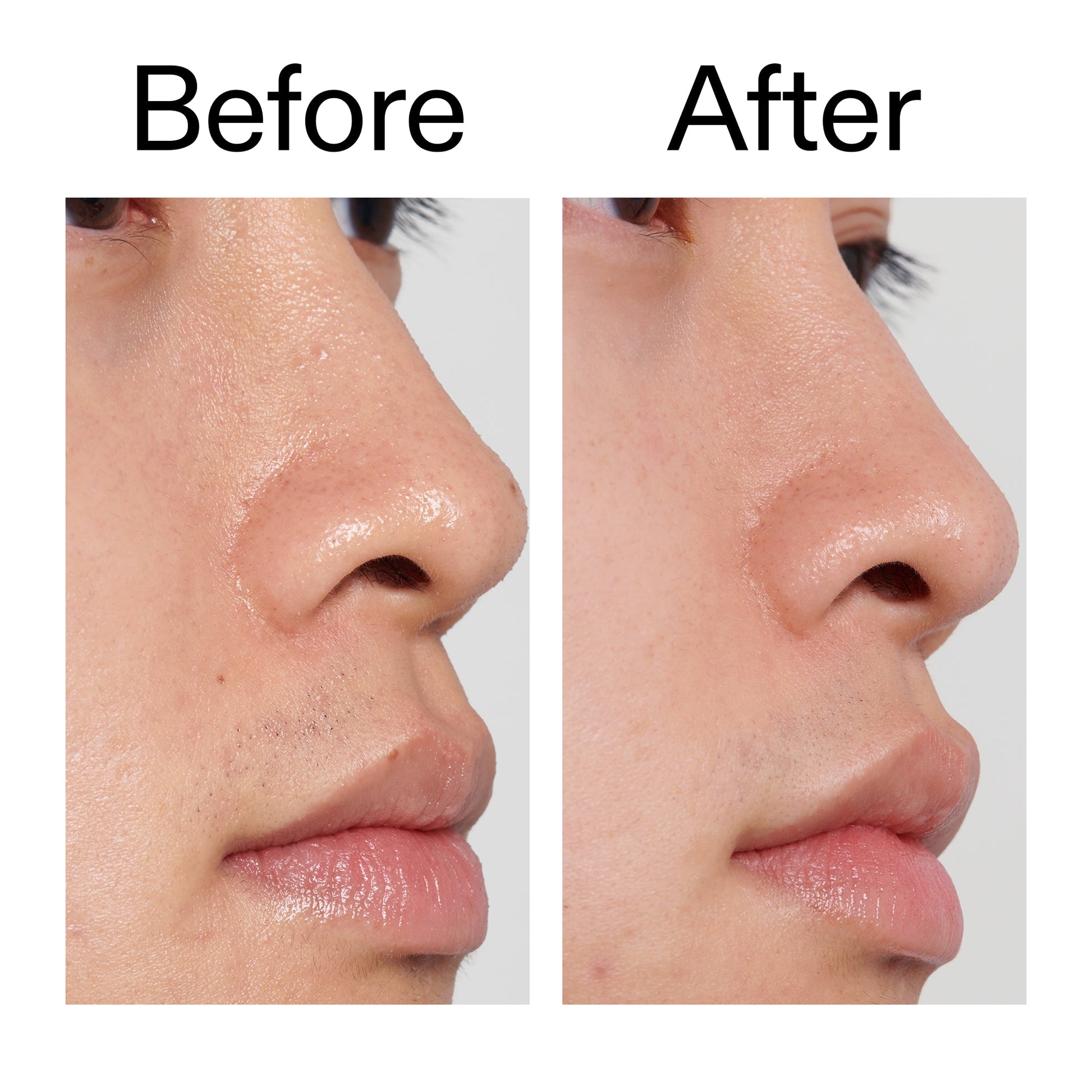 pha-toner-x3 PHA_Toner_Before_After_2000x2000_e3c10172-0150-4342-8b95-57417eaff50d.jpg