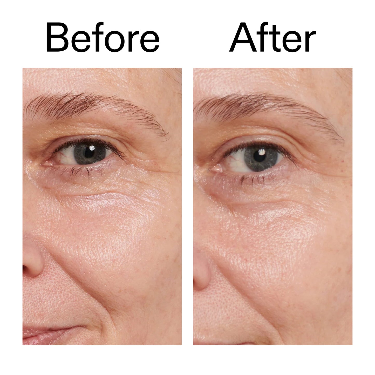retinol-eye-cream-x4 Retinol_Eye_Cream_Before_After_2000x2000_ac03a80c-109e-4572-a95a-91dc109b4d27.jpg