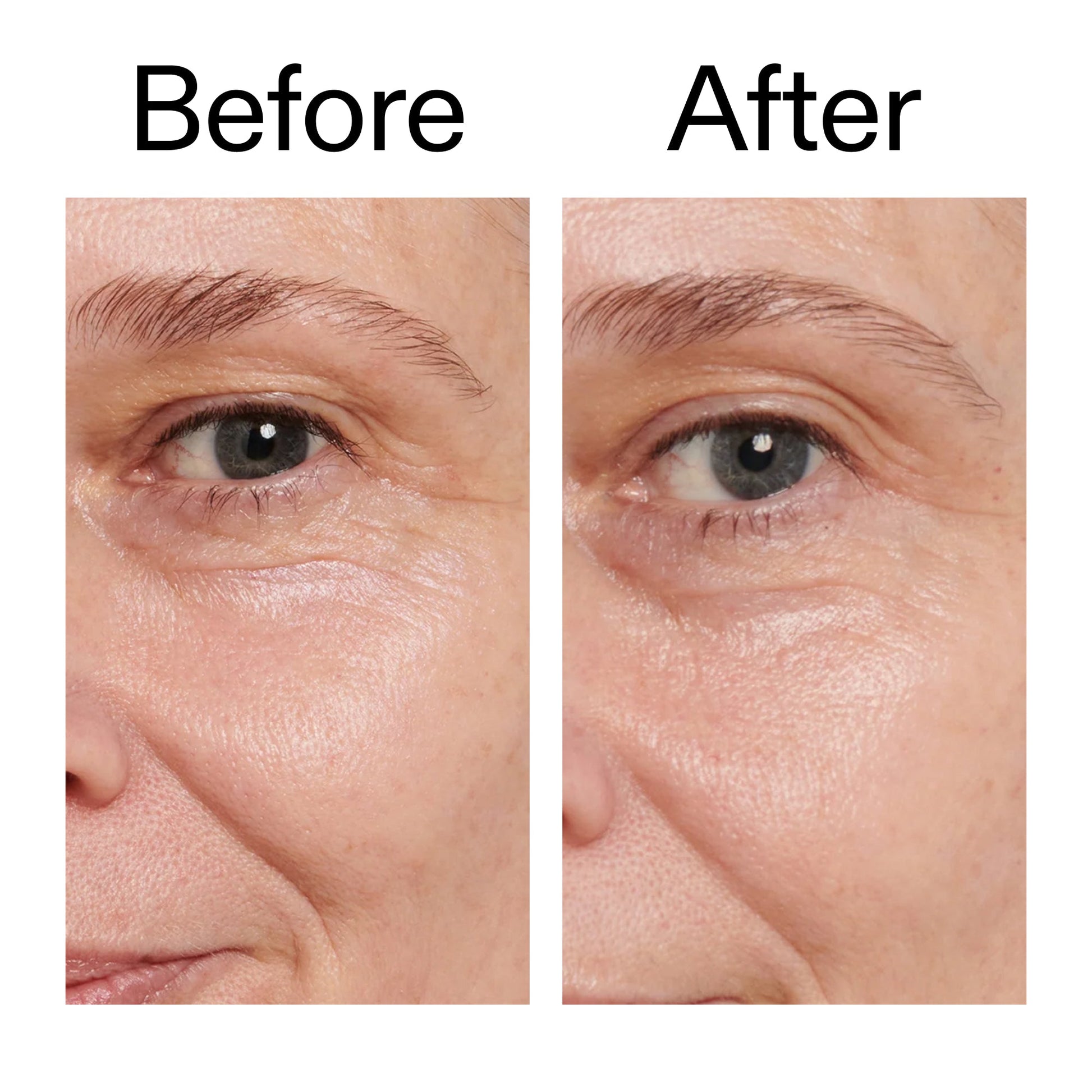 retinol-eye-cream-x4 Retinol_Eye_Cream_Before_After_2000x2000_ac03a80c-109e-4572-a95a-91dc109b4d27.jpg