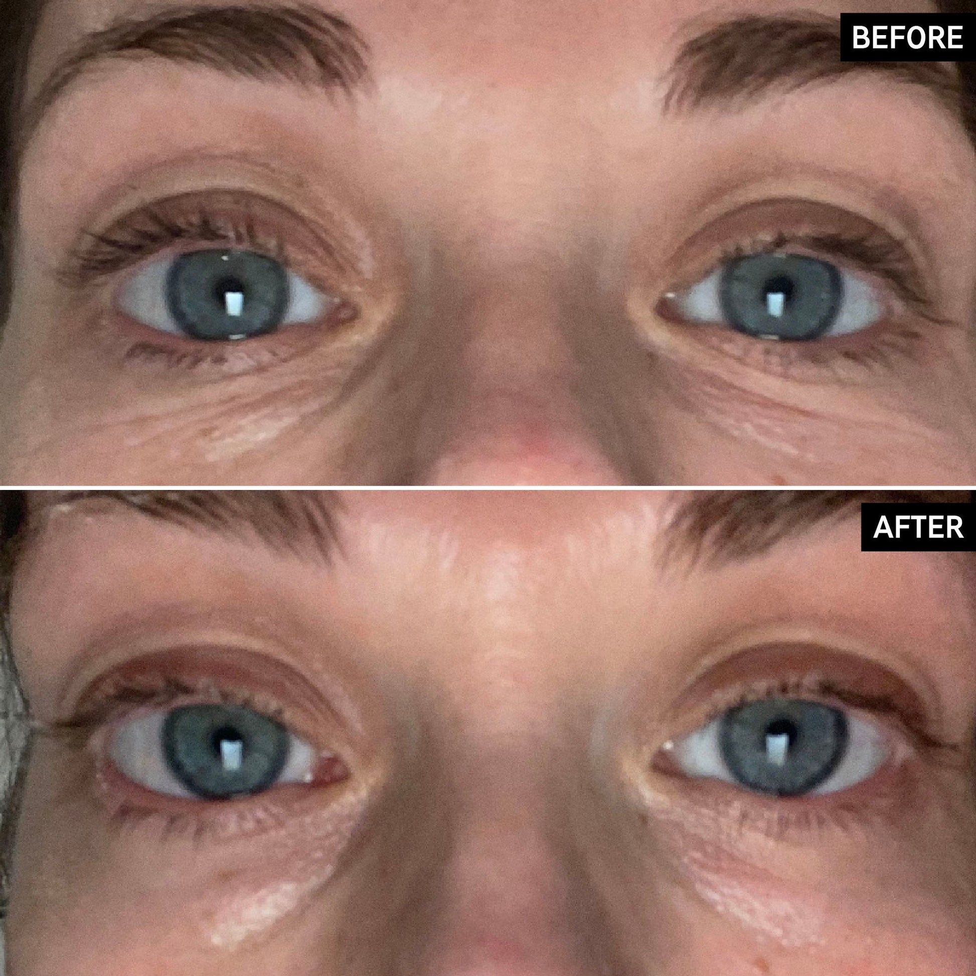 retinol-eye-cream-x4 SITE-UGCBAsApril_Nicole_B_A_PPage_2000x2000_1.jpg