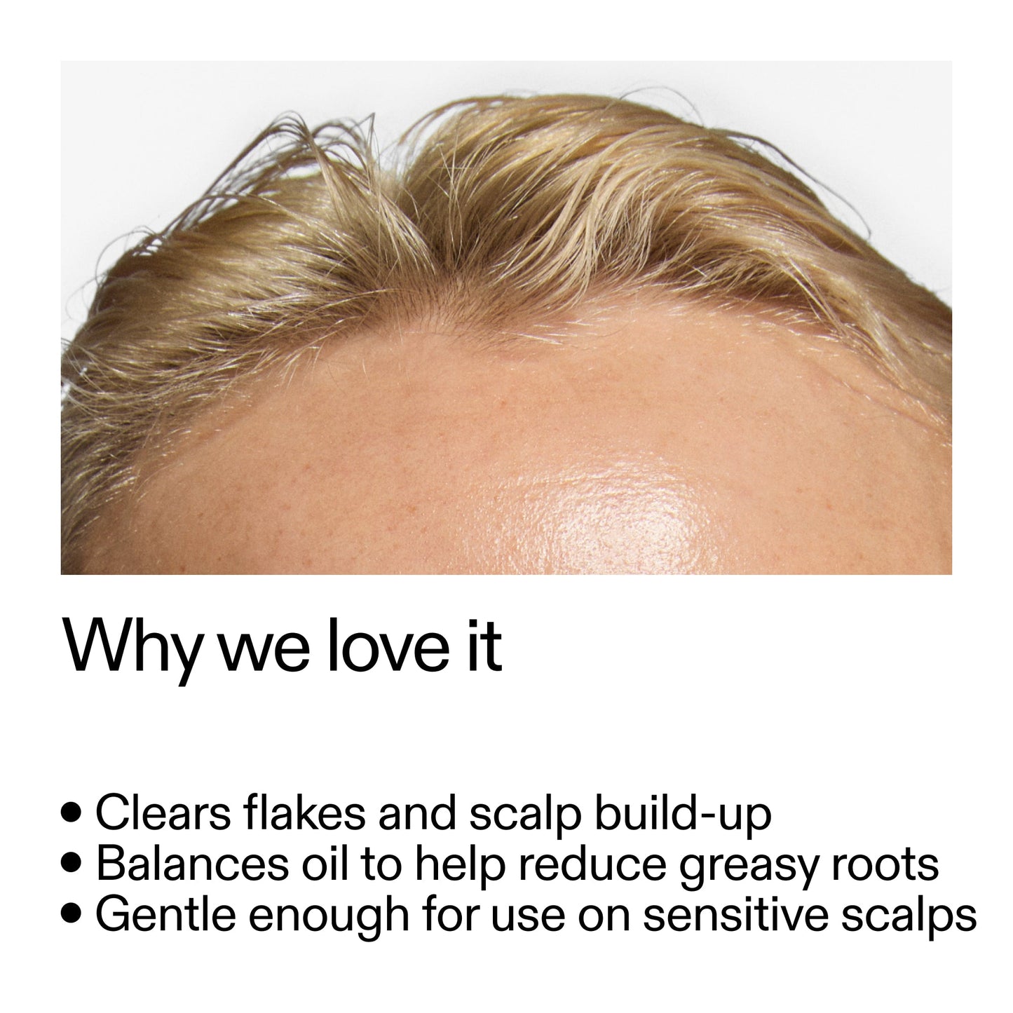 salicylic-acid-exfoliating-scalp-treatment-b0 Salicylic_Acid_Exfoliating_Scalp_Treatment_Why_we_love_it_2000x2000_44b6bd6d-9ec4-4b23-9dc4-bc3fd6f28e14.jpg