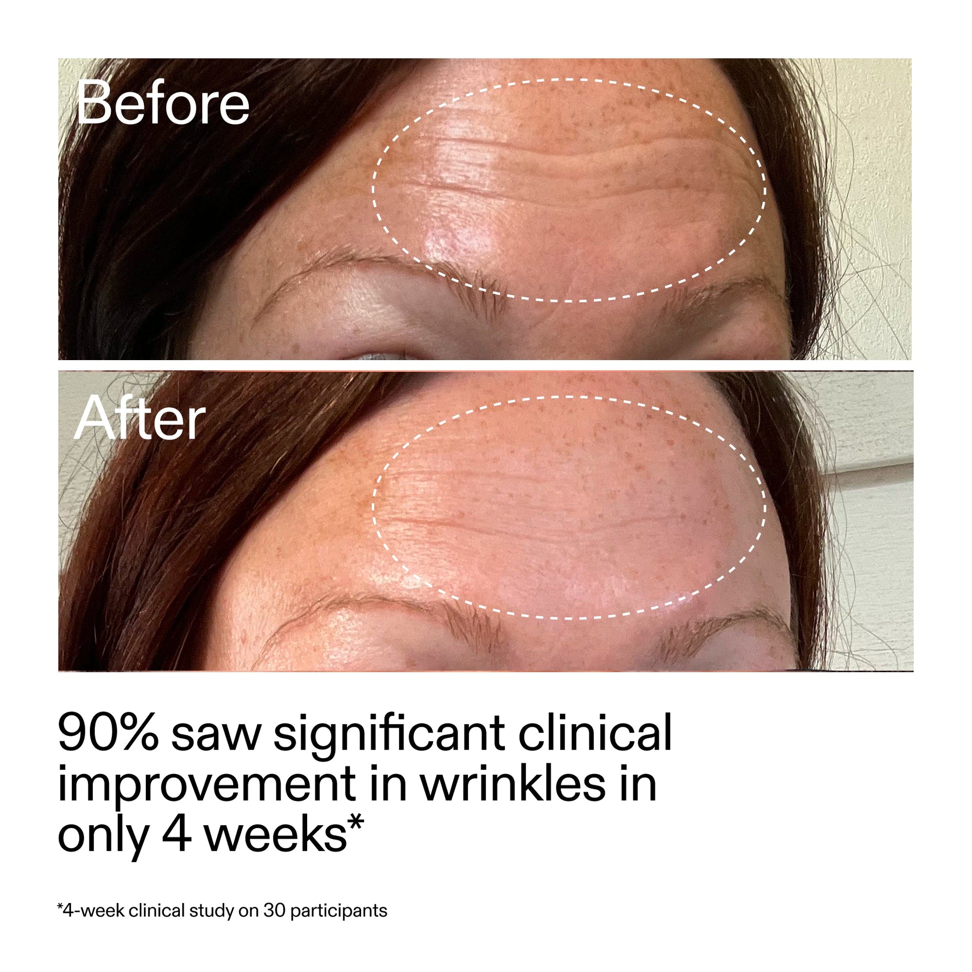 starter-retinol-serum-a7 StarterRetinol_BeforeAfter_Claim1_2000x2000_a09b50b6-4688-4527-abae-21bd142b89b7.jpg