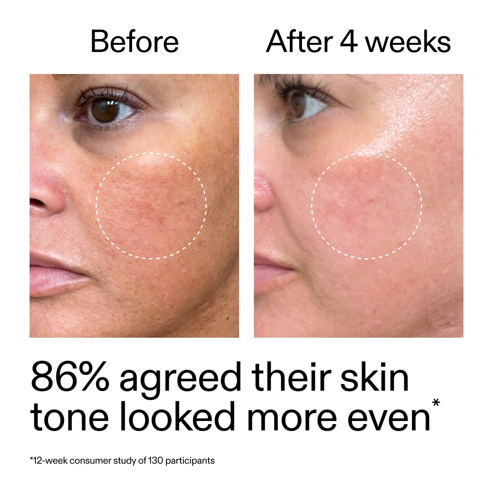 starter-retinol-serum-duo-g4 StarterRetinol_BeforeAfter_Claim2_2000x2000_fc5bb8ac-8588-478f-98d5-28af6651601a.jpg
