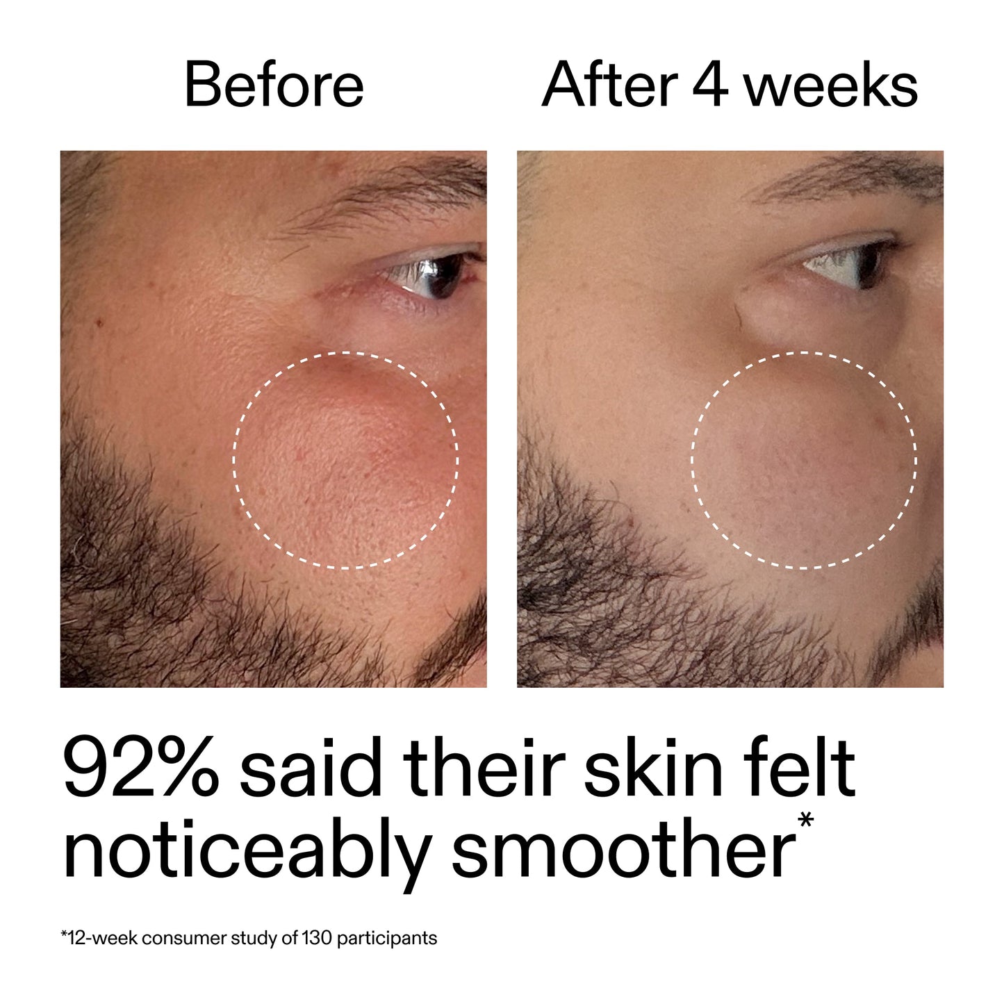 starter-retinol-serum-a7 StarterRetinol_BeforeAfter_Claim3_2000x2000_6ceab106-e0ee-4ed4-ba62-41bc39538038.jpg