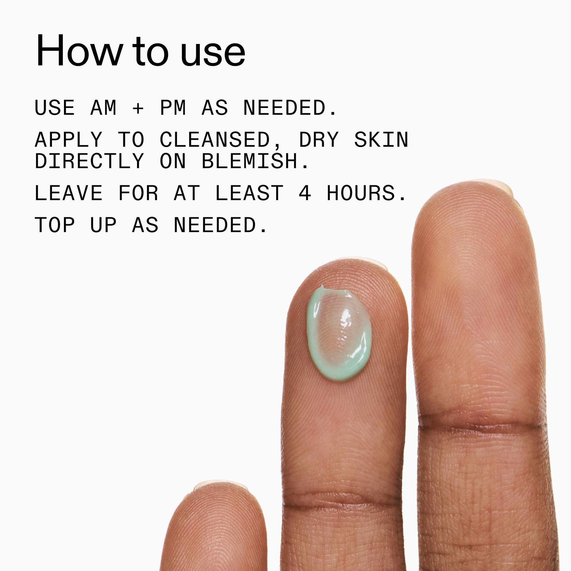 succinic-acid-acne-treatment-i3 Succinic_Acid_Treatment_How_to_Use_2000x2000_d57137d5-d7f1-427c-9a46-5fc00c19c542.jpg