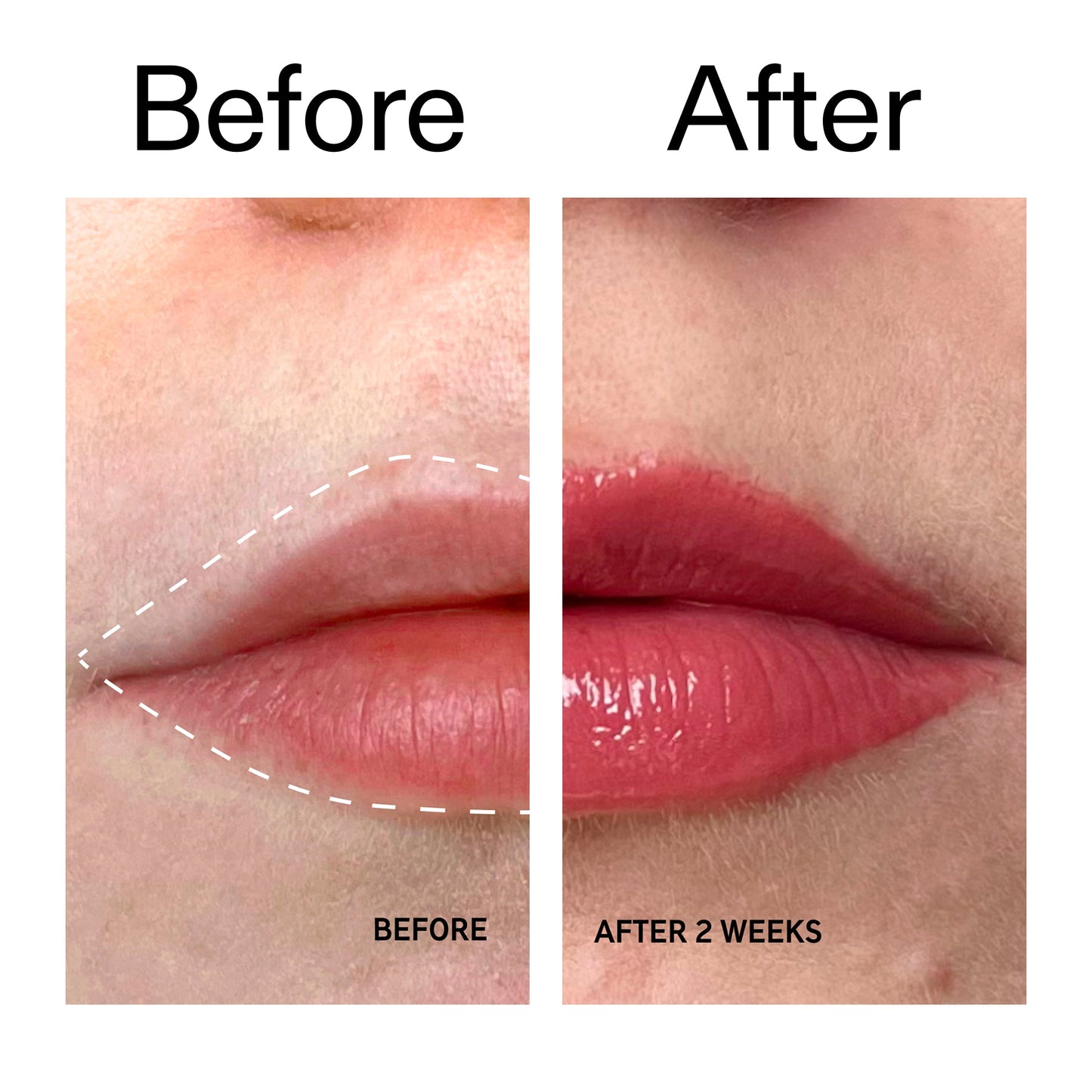 tripeptide-plumping-berry-lip-balm-i2 Tripeptide_Plumping_Lip_Balm_-_Berry_Before_After_2000x2000_9474bbd8-43ca-4b0e-b0e7-dfab70b91927.jpg