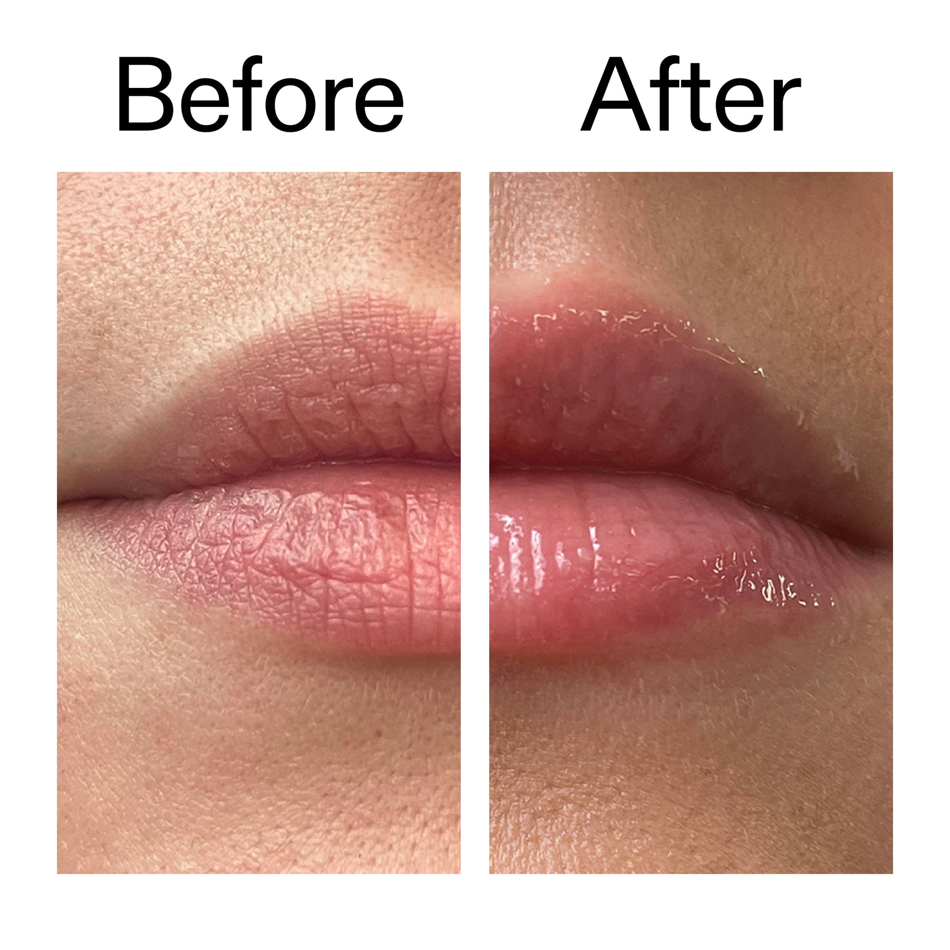 lip-plumping-duo-a7 Tripeptide_Plumping_Lip_Balm_Before_After_2000x2000_b4a5ee04-d2ac-4857-8f01-17209acc4bf3.jpg