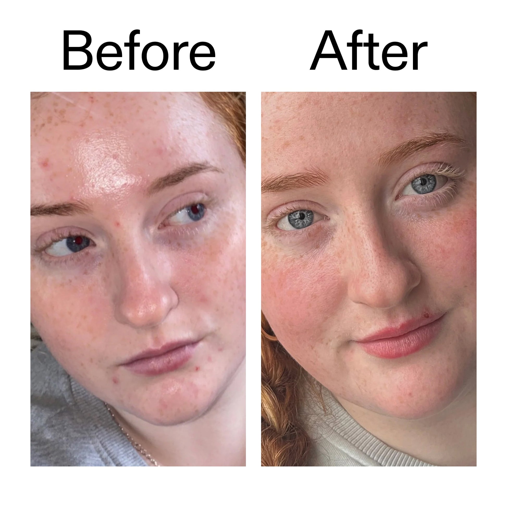 vitamin-b-c-and-e-moisturizer-y6 Vitamin_B_C_and_E_Moisturizer_Before_After_2000x2000_b0781a76-5ad2-4be9-95b8-ef92b356833c.jpg